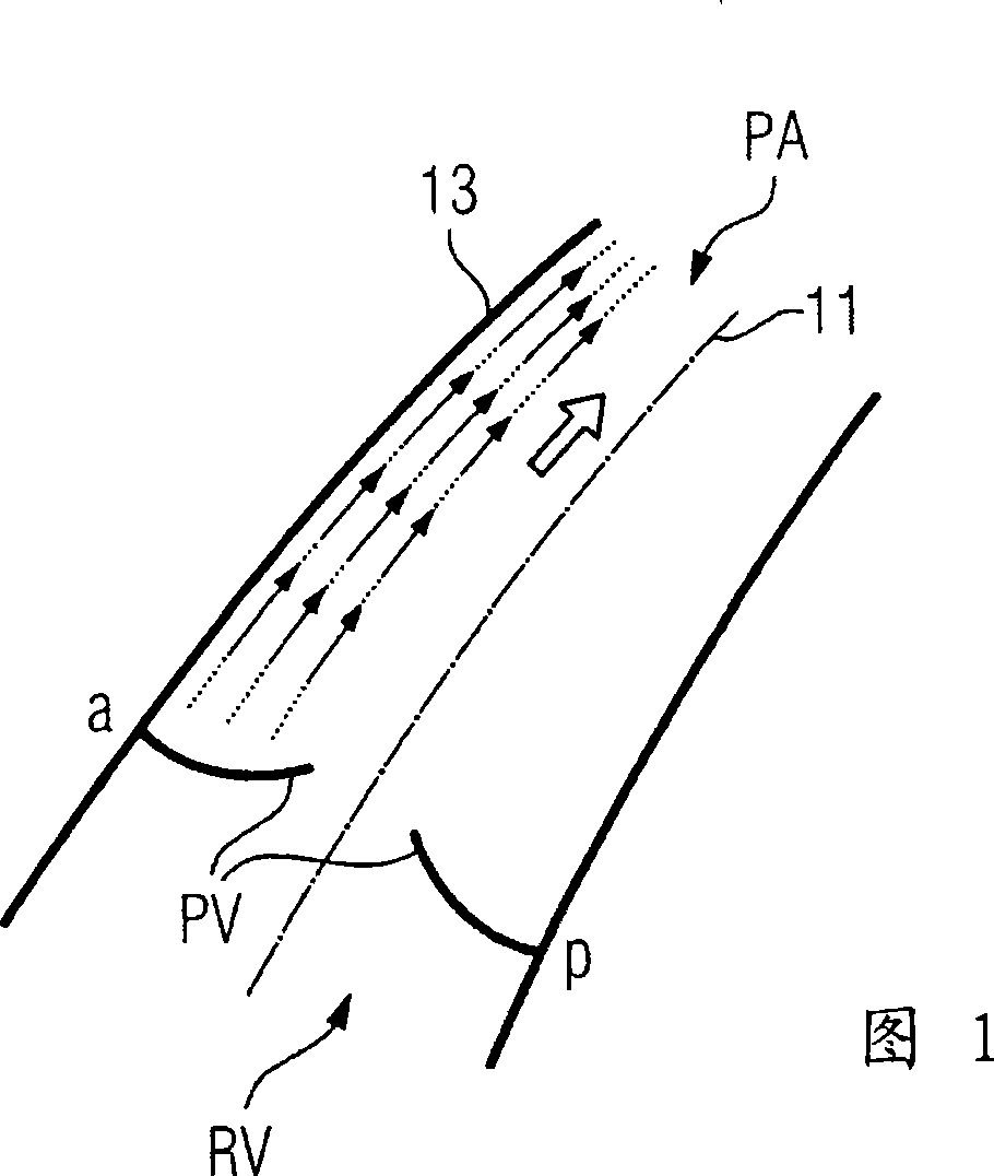 Method and medical imaging apparatus for examination of human or animal body