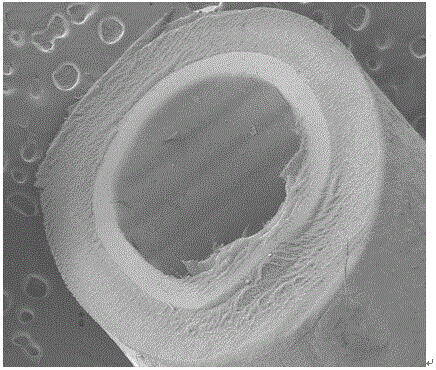 Preparation method of double-layer intravascular stent