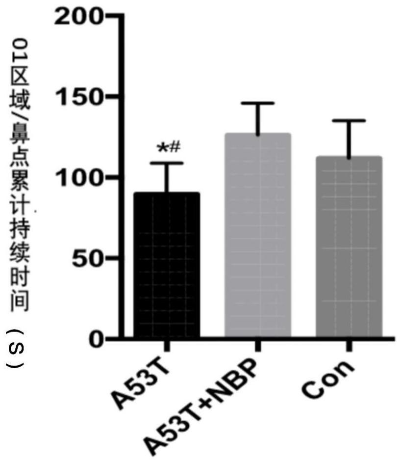 Application of butylphthalide in preparation of medicine for treating dementia with Lewy bodies