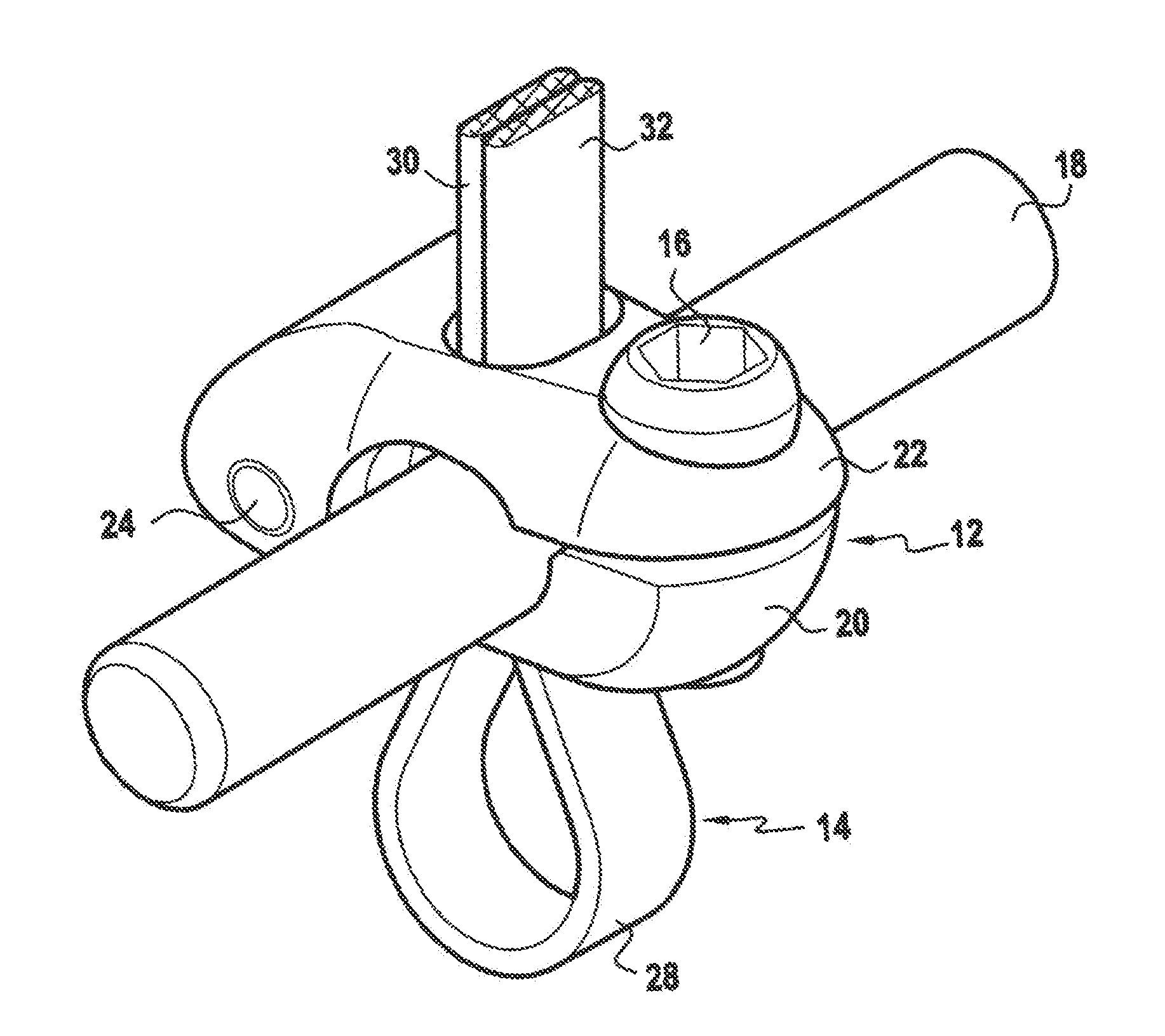 Method and instrument for tensioning a flexible tie