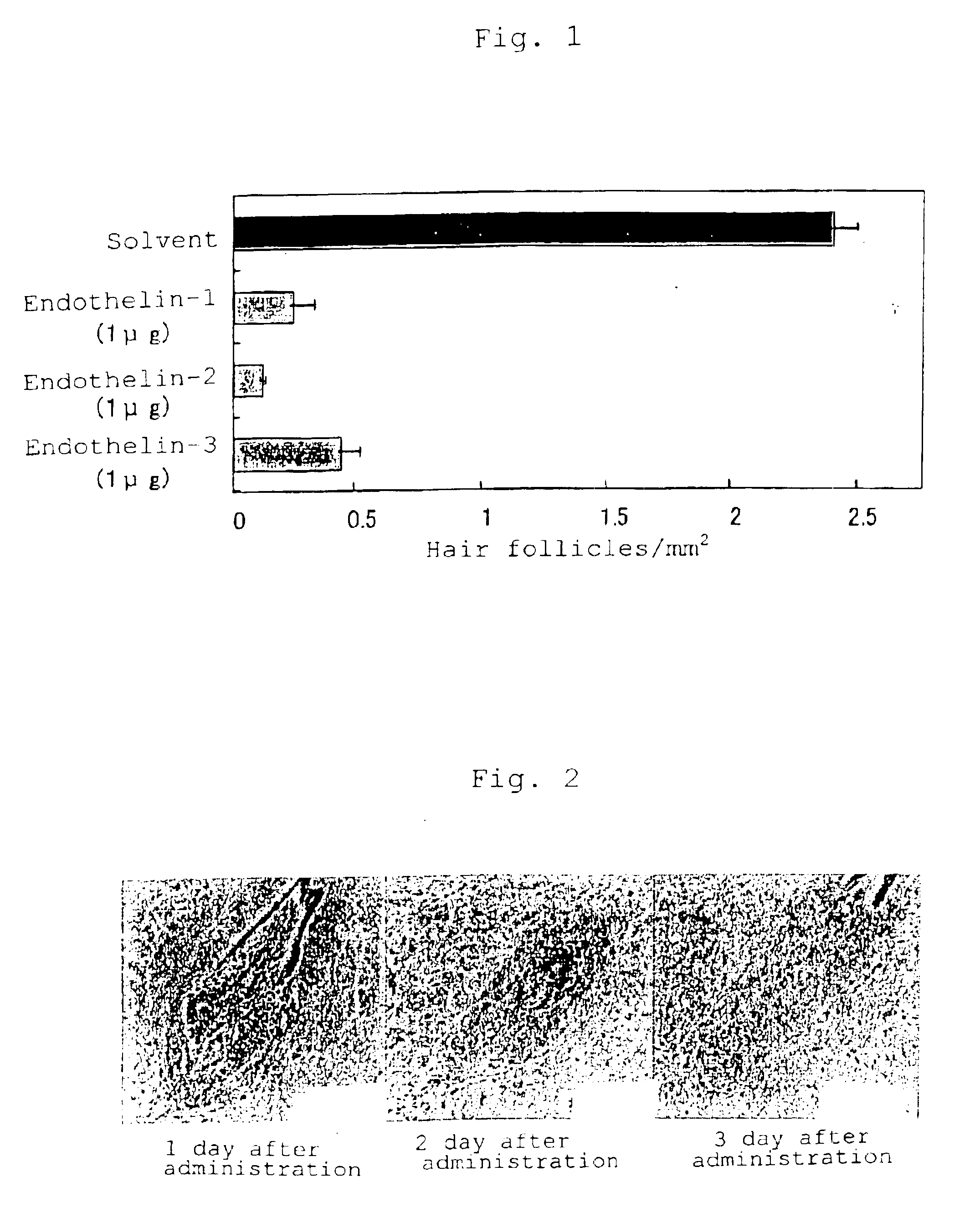 Depilatories and agents for external use