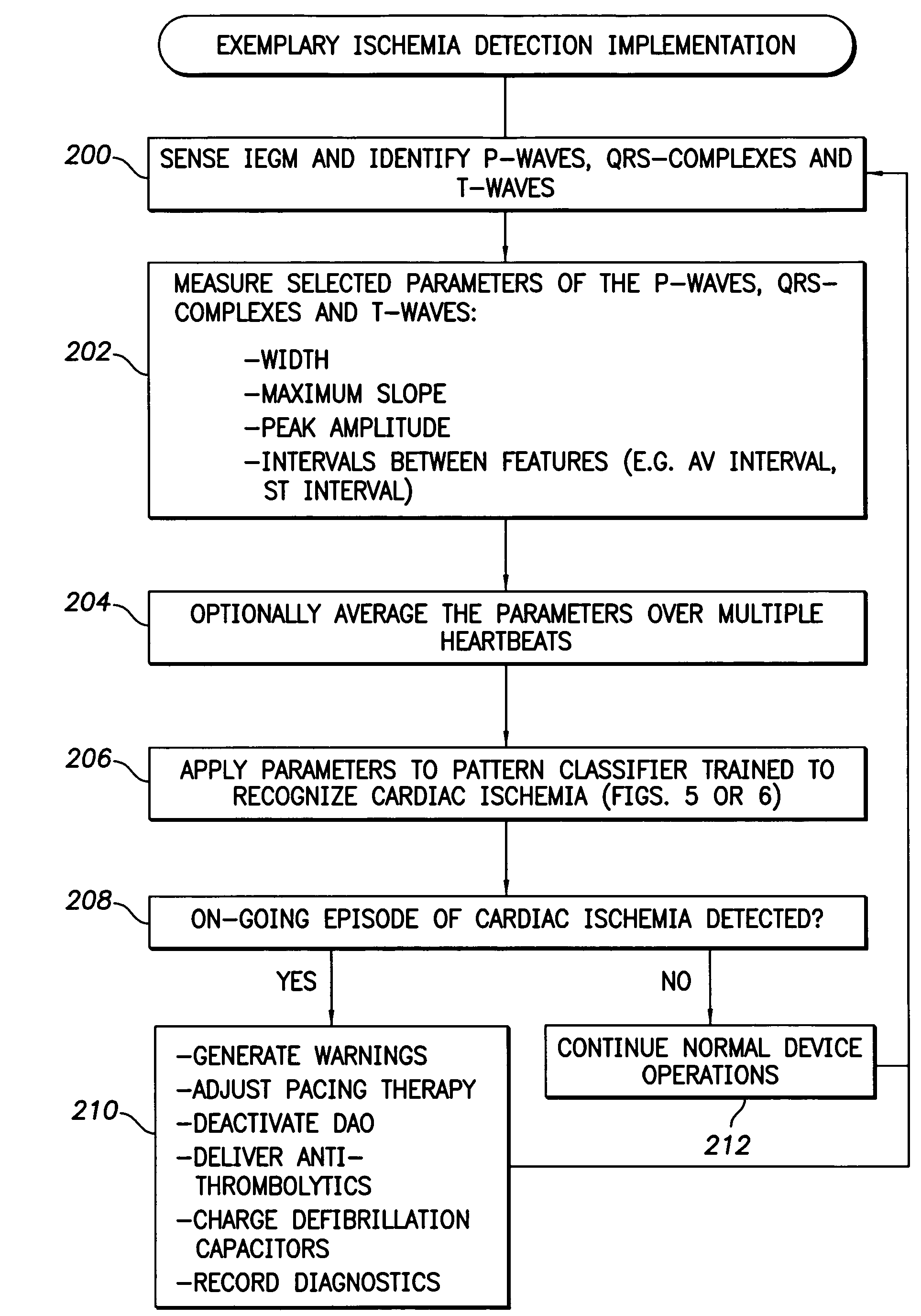 System and method for detecting cardiac ischemia in real-time using a pattern classifier implemented within an implanted medical device