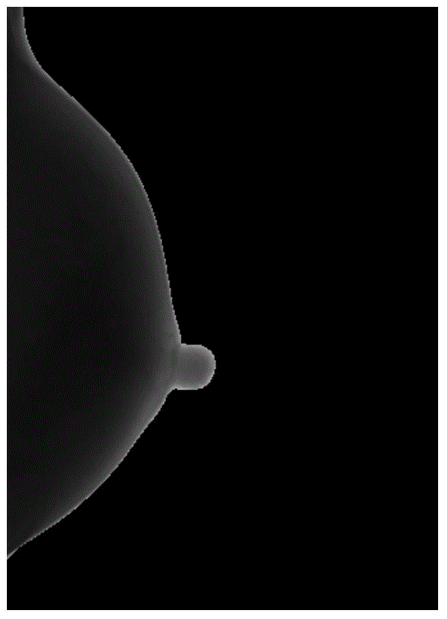 Mammary gland image processing method and device