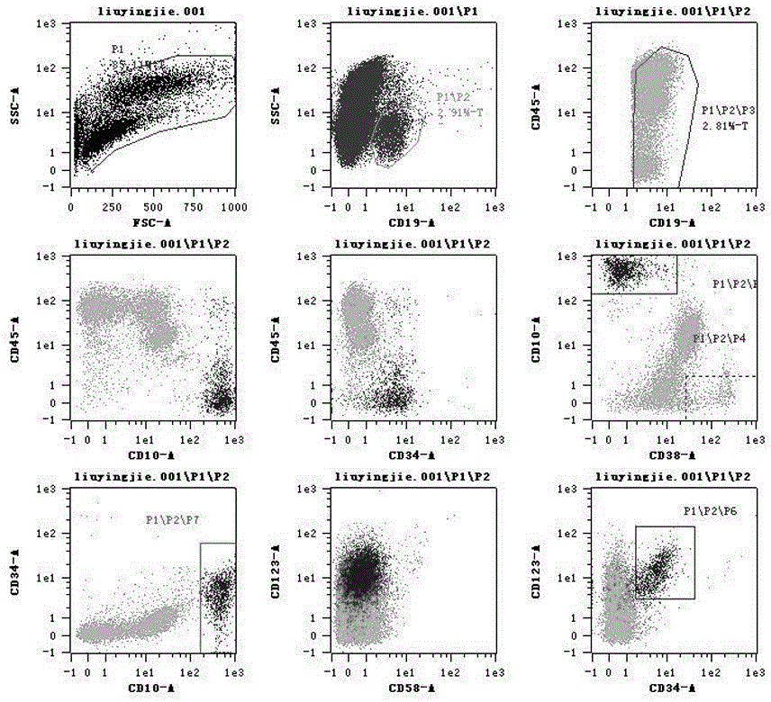 Kit and application thereof for detecting immunophenotypes associated with acute b lymphocytic leukemia