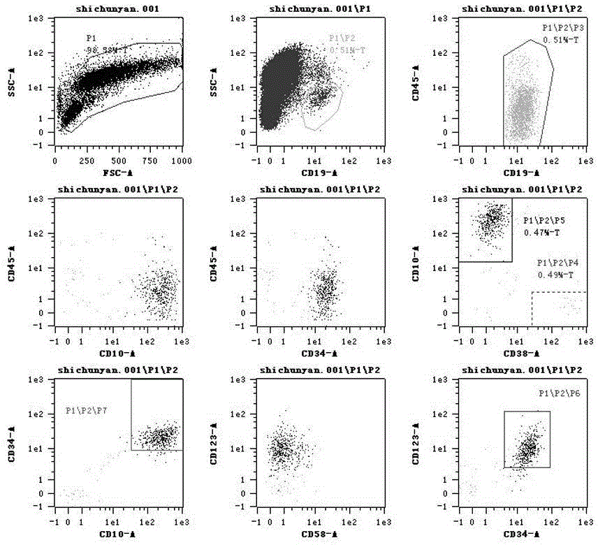 Kit and application thereof for detecting immunophenotypes associated with acute b lymphocytic leukemia