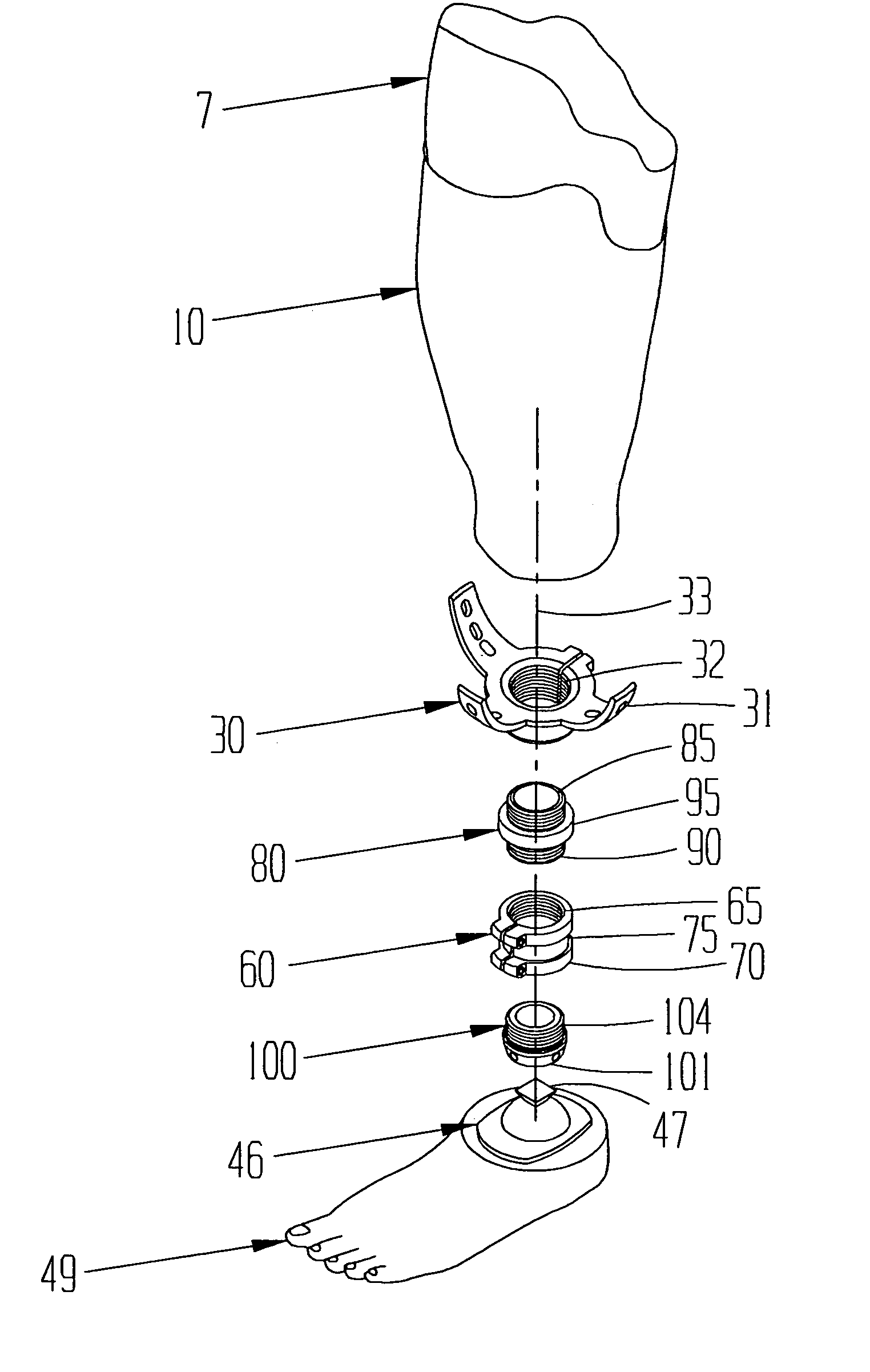 Limb with modular prosthetic components