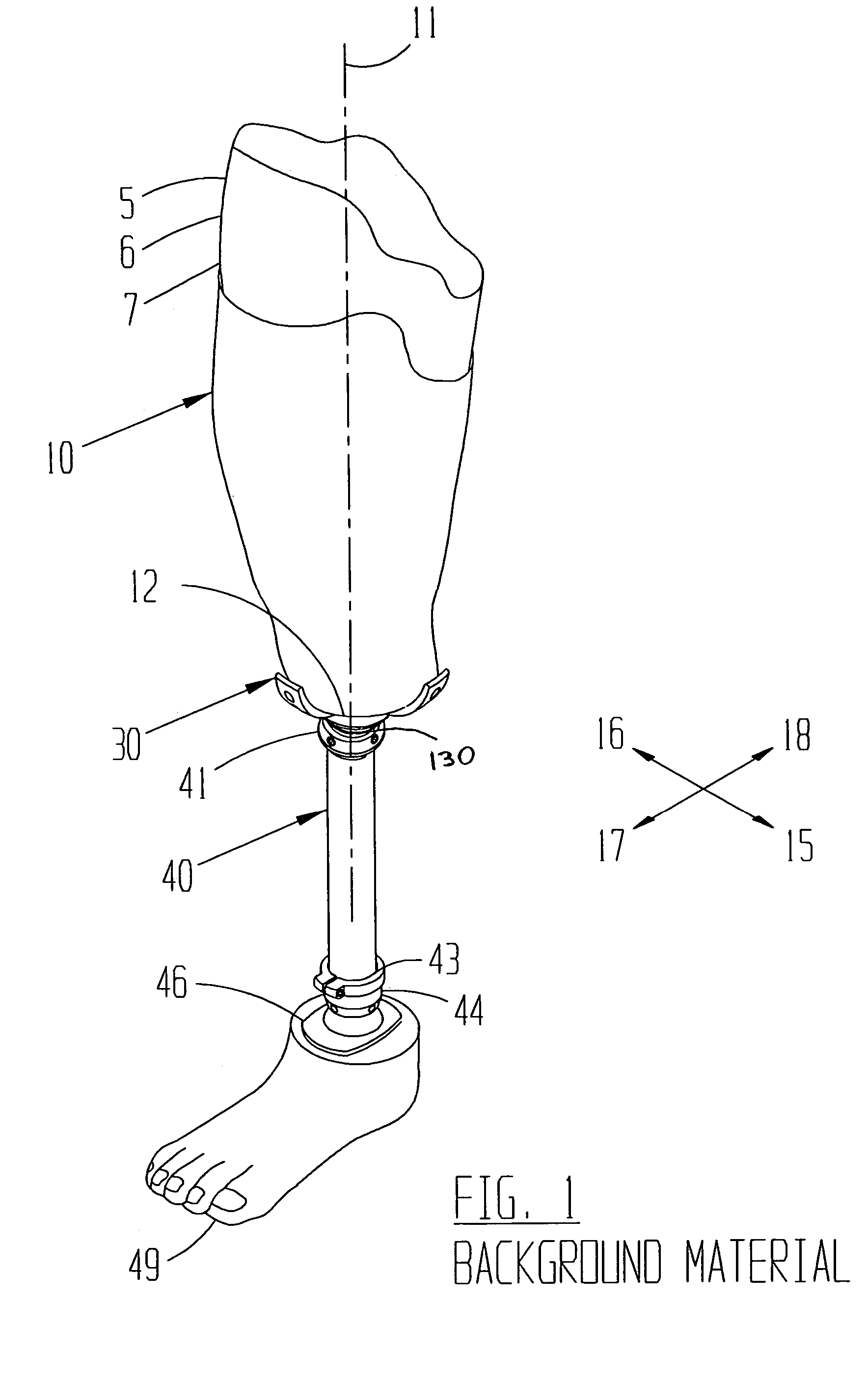 Limb with modular prosthetic components