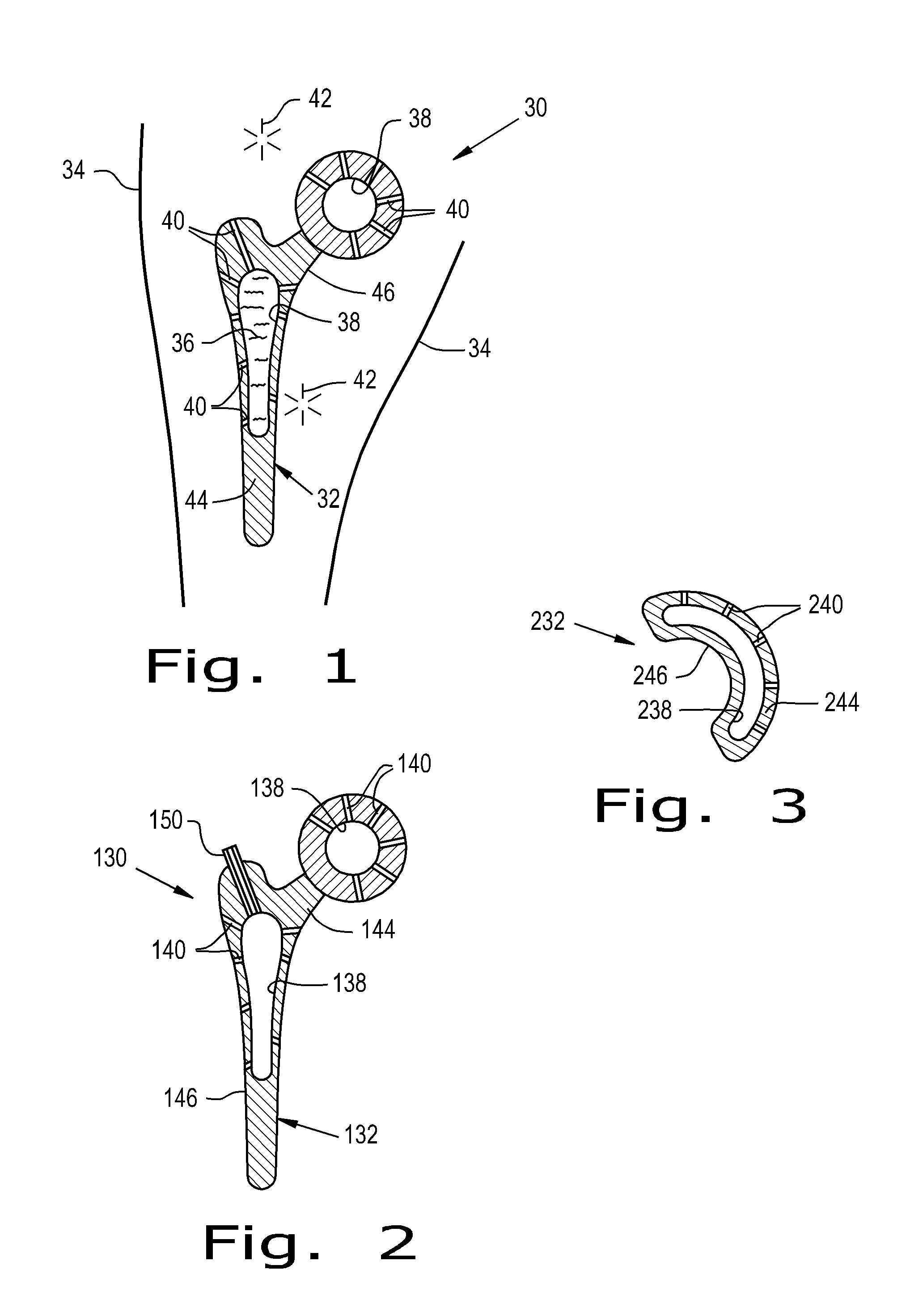 Drug delivery implants