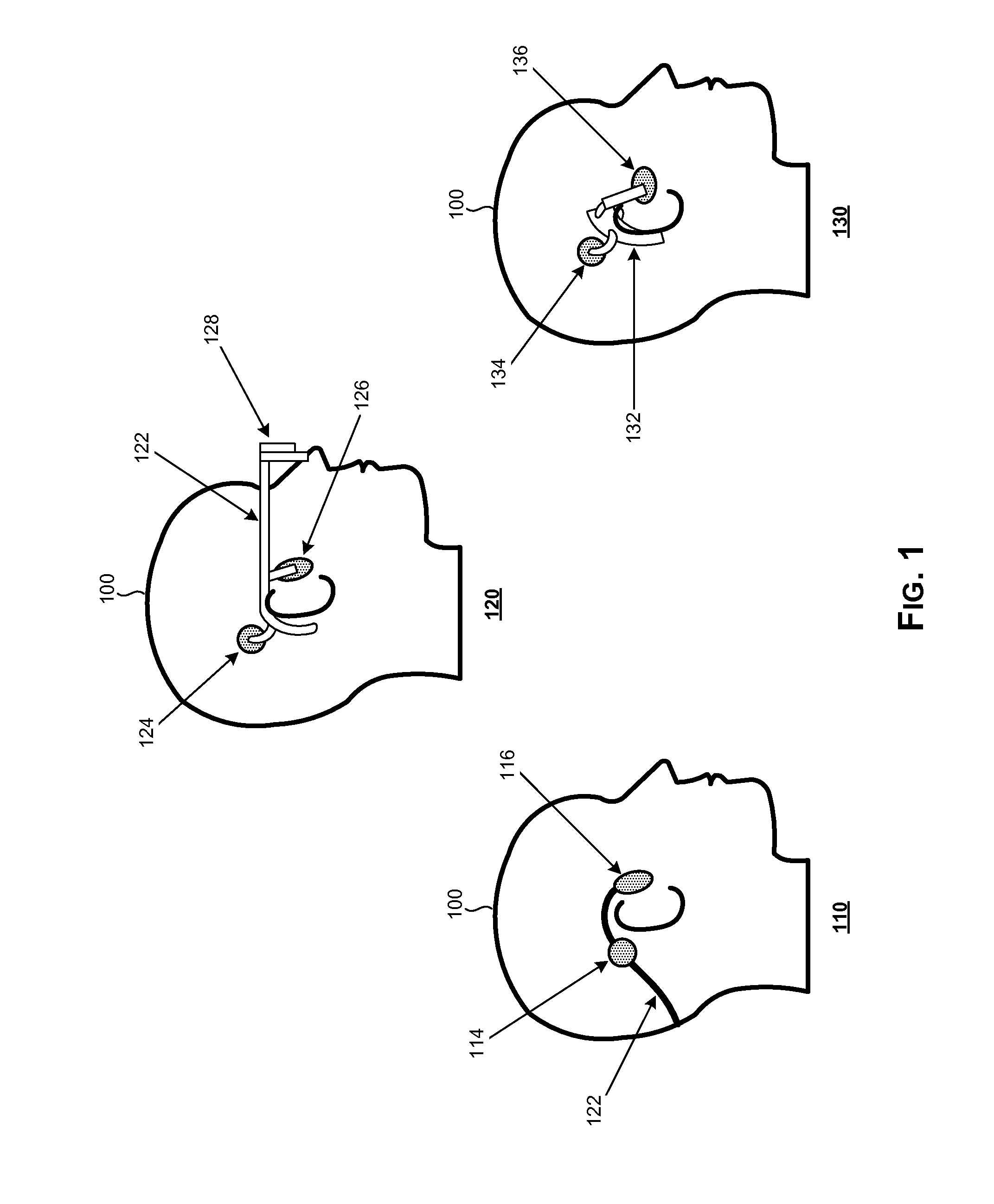 Equalization and power control of bone conduction elements