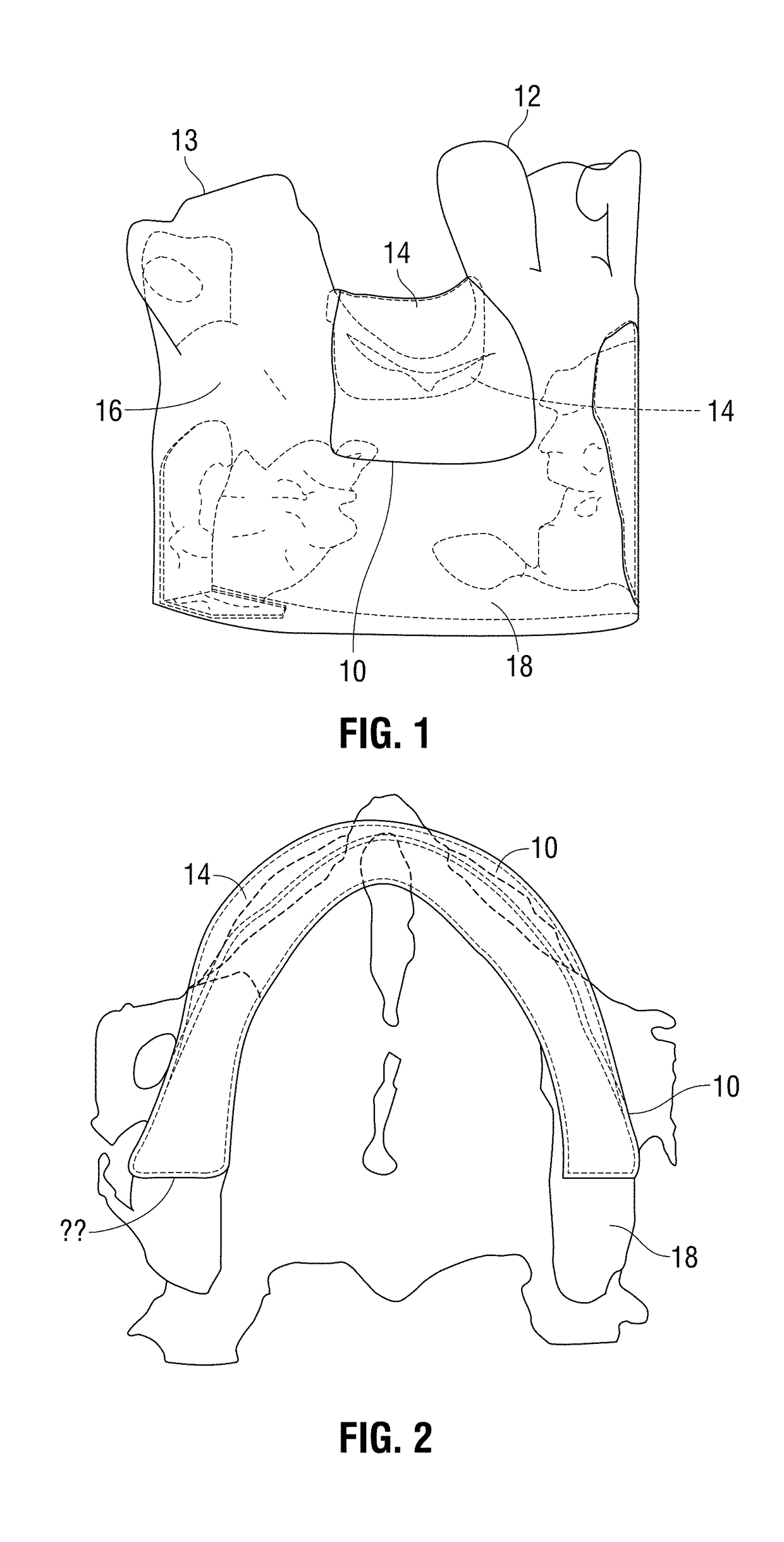 Method and system for making and using an occlusive barrier for bone regeneration and occlusive barrier obtained by said method