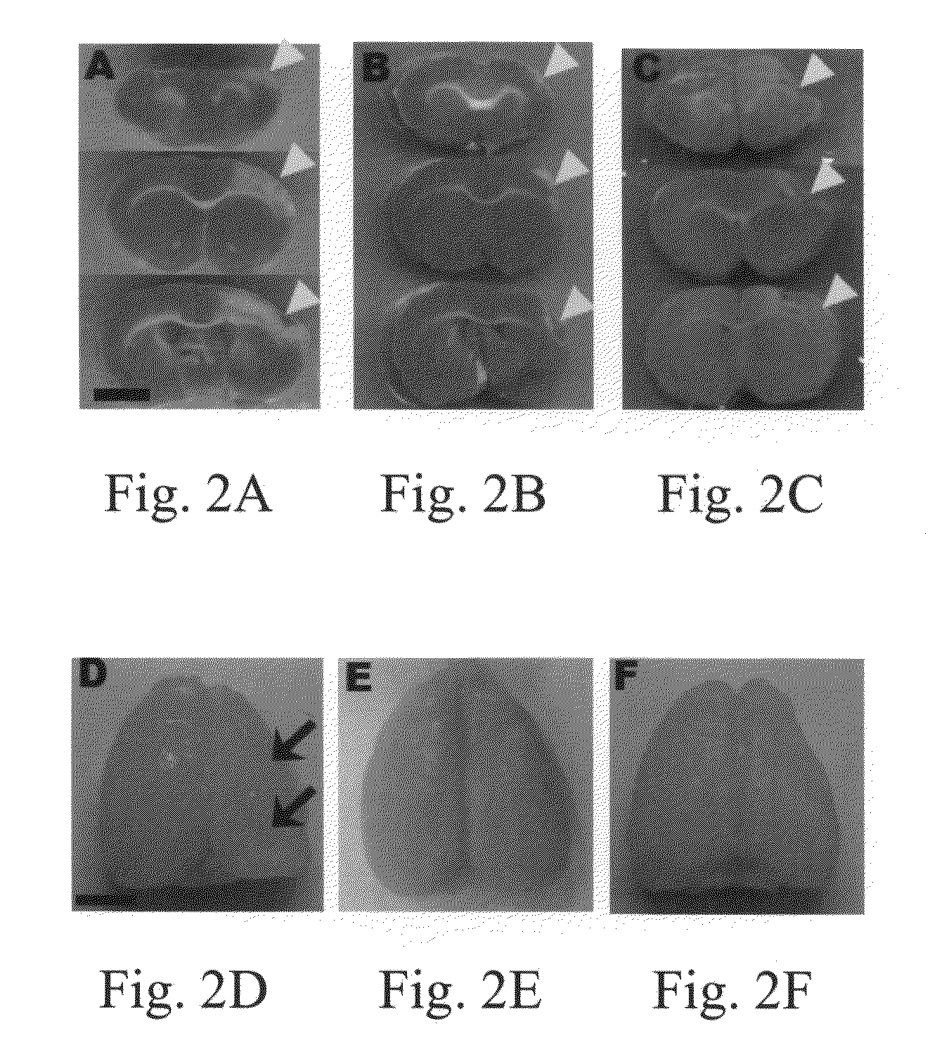 Method for treating brain ischemic injury through transplantation of human umbilical mesenchymal stem cells