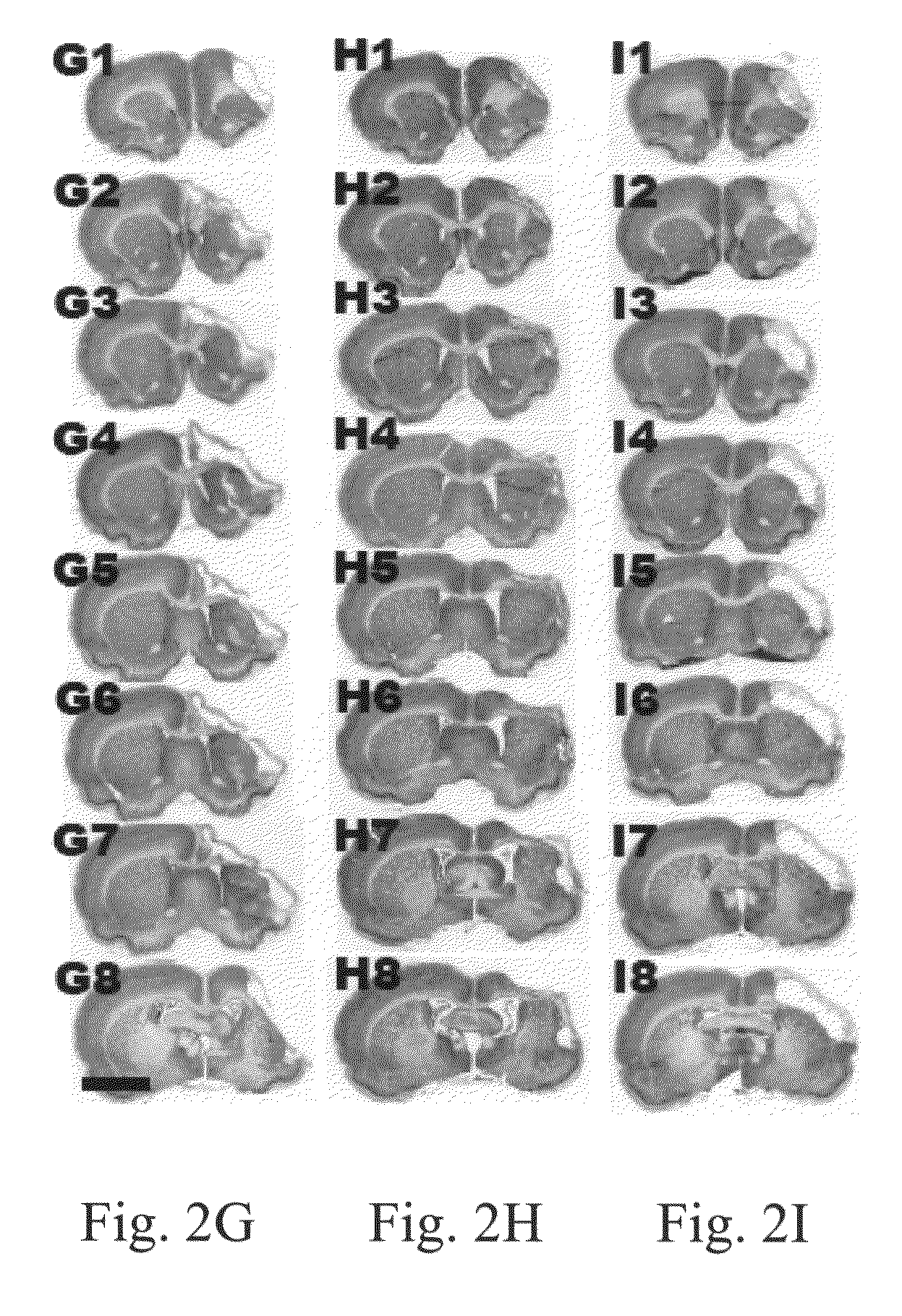 Method for treating brain ischemic injury through transplantation of human umbilical mesenchymal stem cells