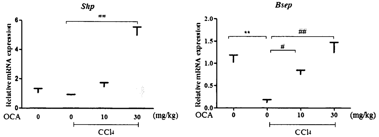 Application of combination of Farnesoid XReceptor (FXR) agonist and apoptotic inhibitor in preparation of superior anti-hepatic fibrosis drugs