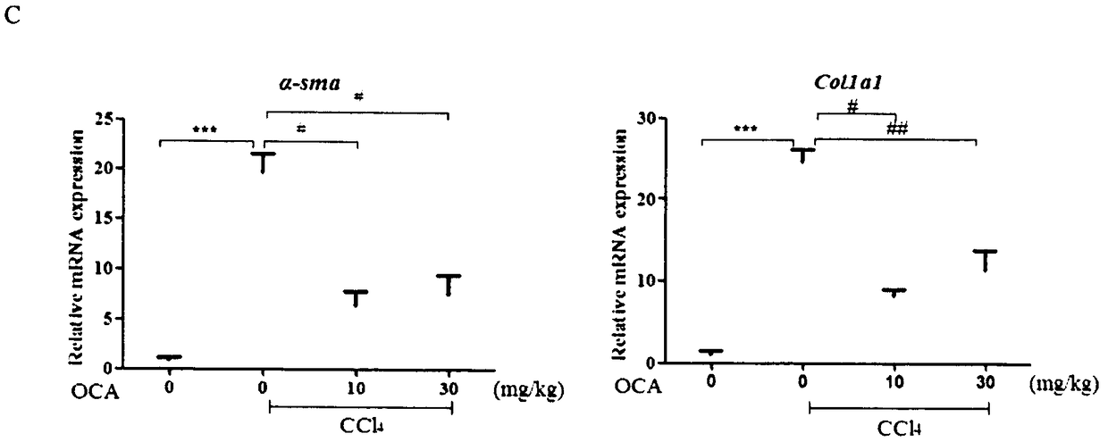 Application of combination of Farnesoid XReceptor (FXR) agonist and apoptotic inhibitor in preparation of superior anti-hepatic fibrosis drugs