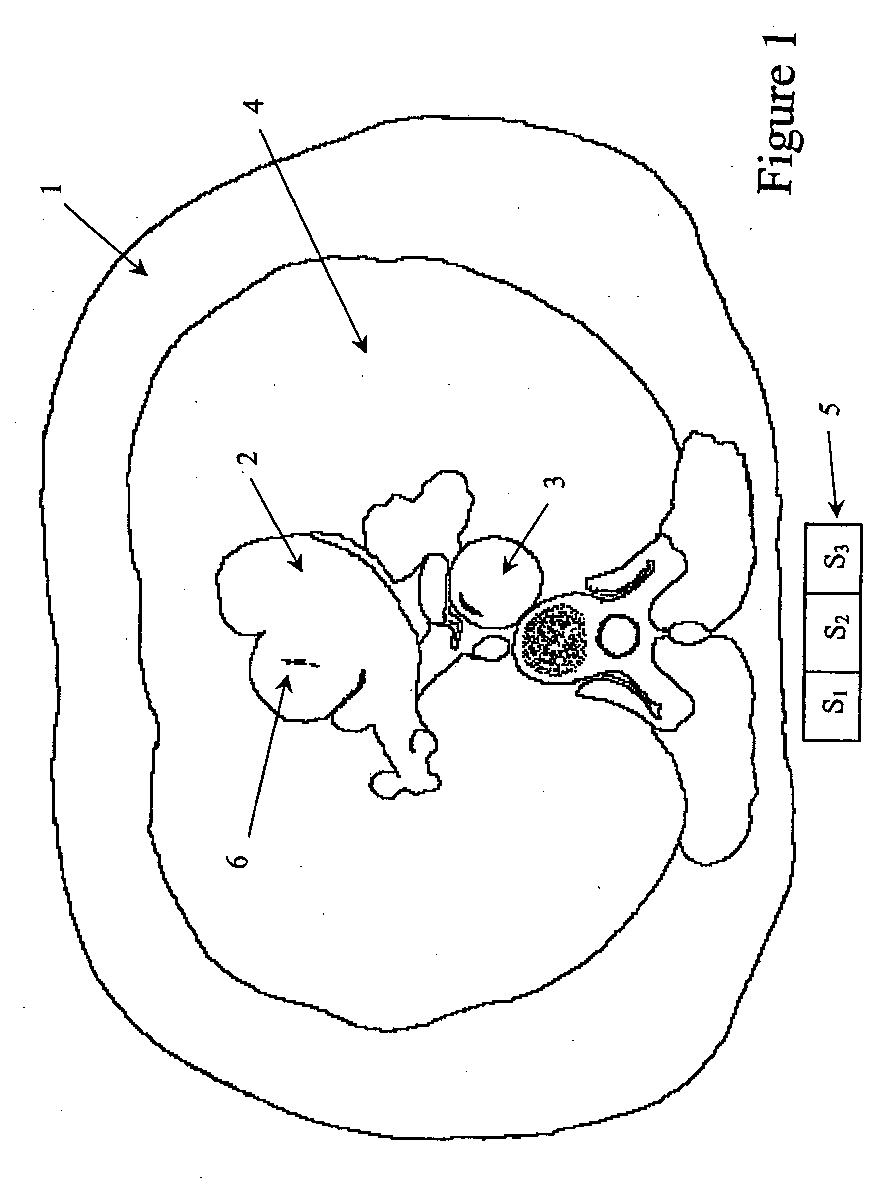 Calibration of tissue densities in computerized tomography