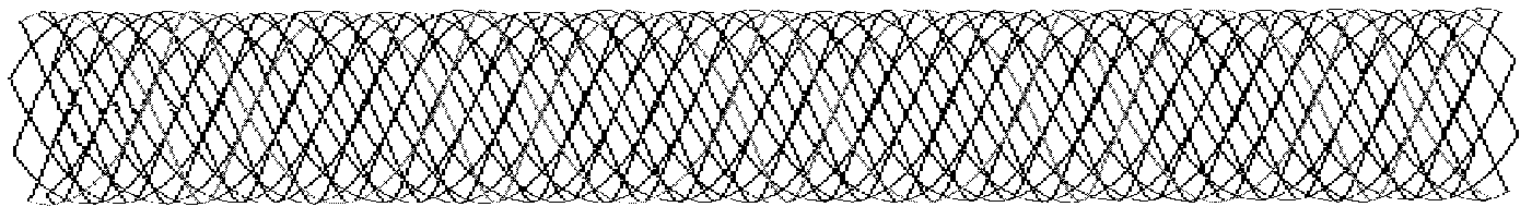 Mesh tubular spring for embolism and preparation method thereof