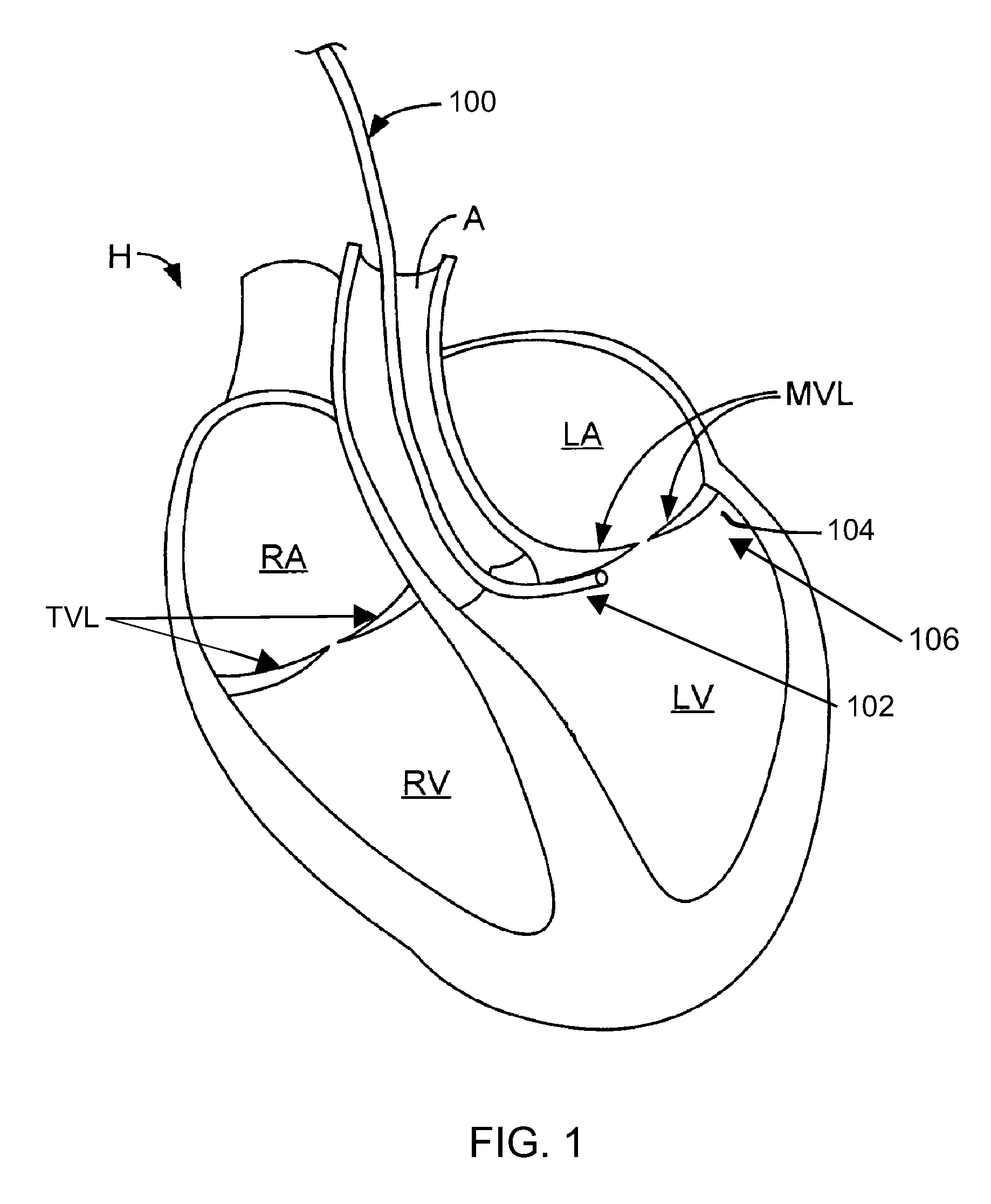 Multi-window guide tunnel