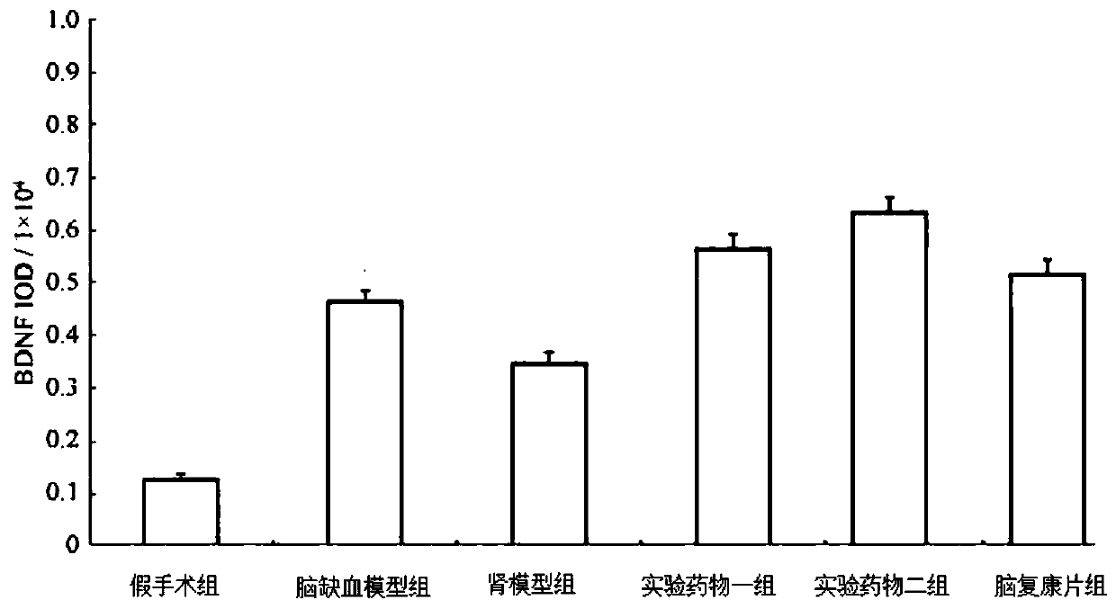 Kidney-tonifying traditional Chinese medicine composition for treating ischemic brain injury and preparation method thereof