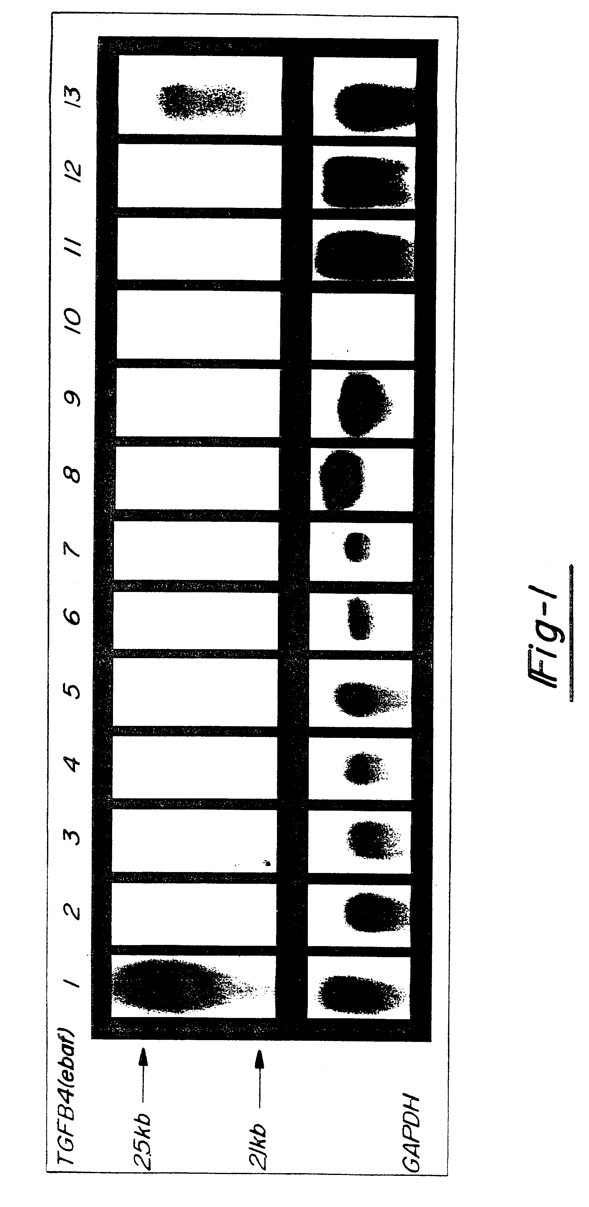 Nucleic acids encoding an endometrial bleeding associated factor (ebaf)