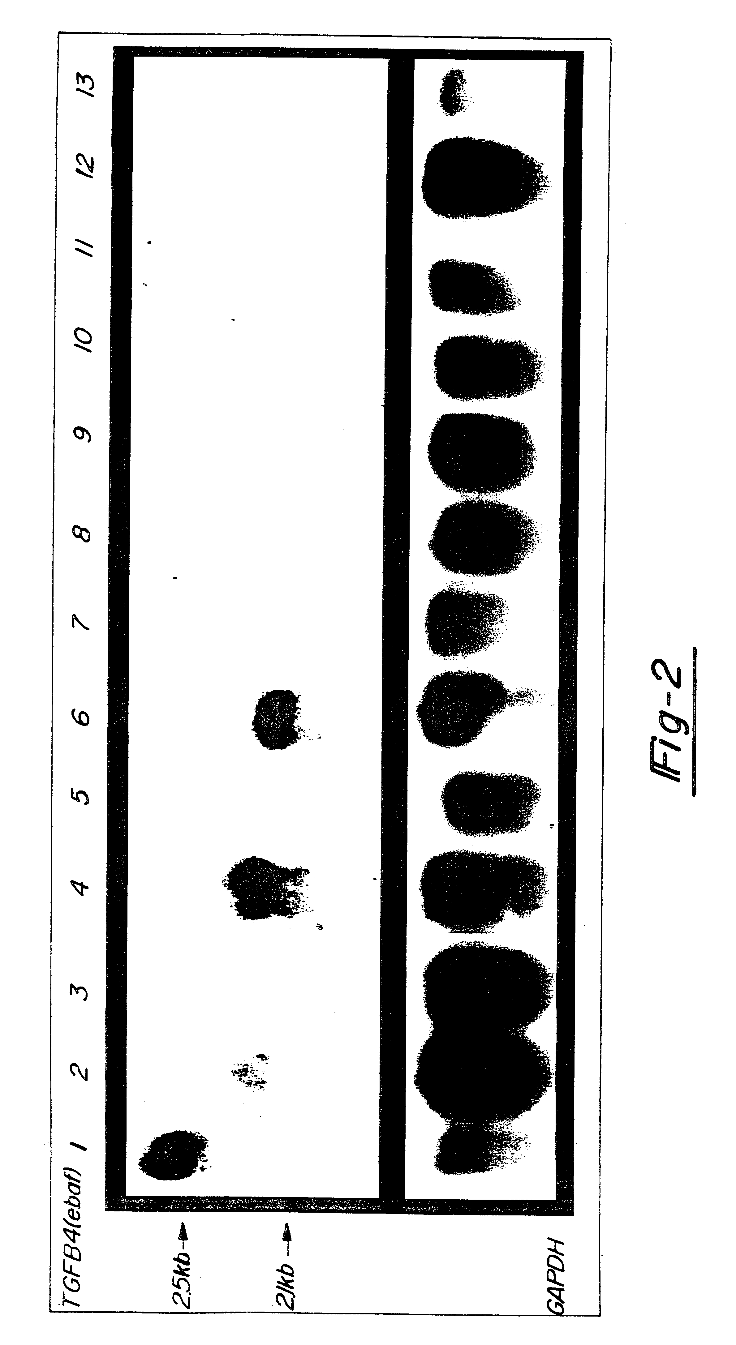 Nucleic acids encoding an endometrial bleeding associated factor (ebaf)