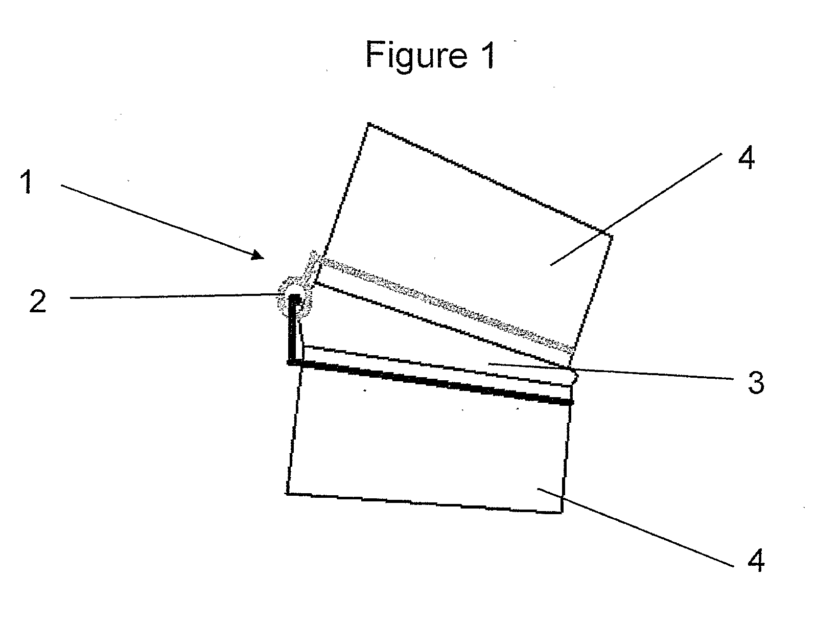 Implantable apparatus for modulation of skeletal growth