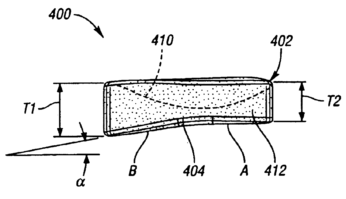 Surgically implantable knee prosthesis having medially shifted tibial surface