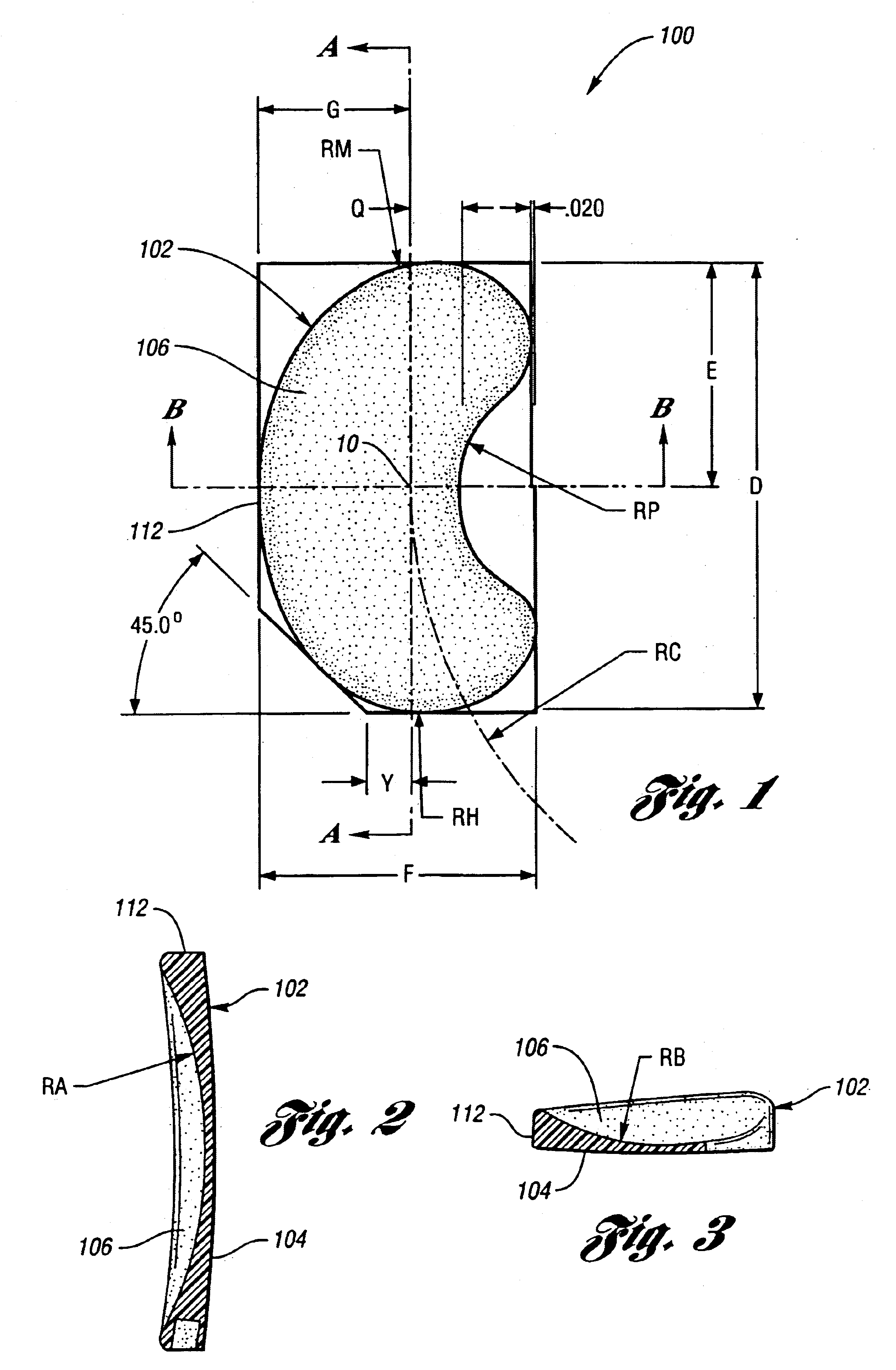 Surgically implantable knee prosthesis having medially shifted tibial surface