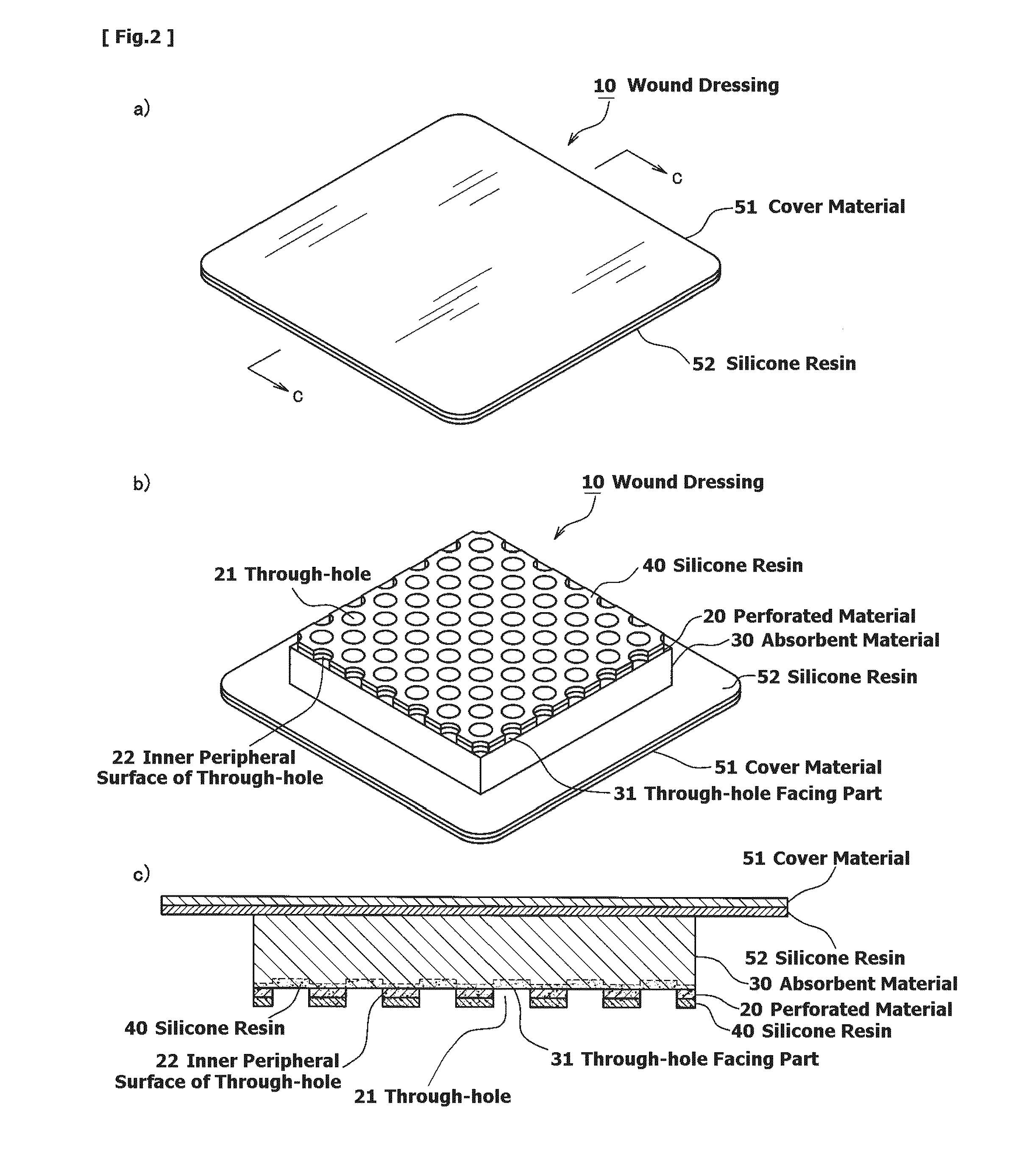 Wound dressing and method for producing it