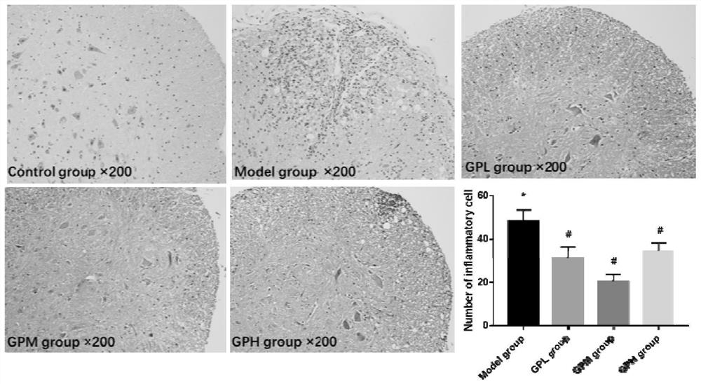 Application of Geniposide in the Preparation of Drugs for Treating Multiple Sclerosis