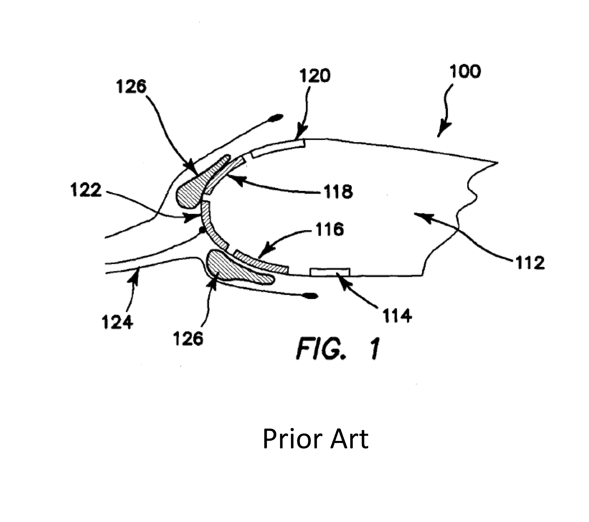 Uniform Heat Distribution in Resistive Heaters For Anti-Icing and De-Icing