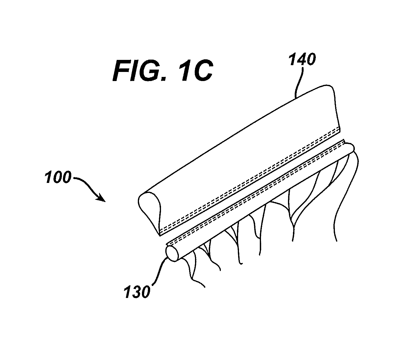 Method of Filling an Intraluminal Reservoir with a Therapeutic Substance