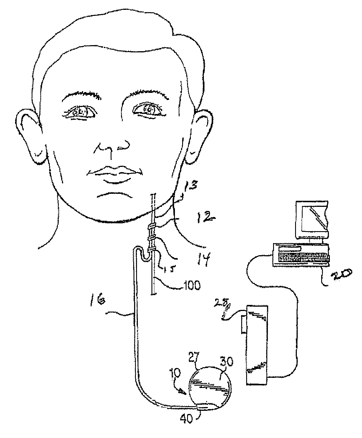 Trained and adaptive response in a neurostimulator