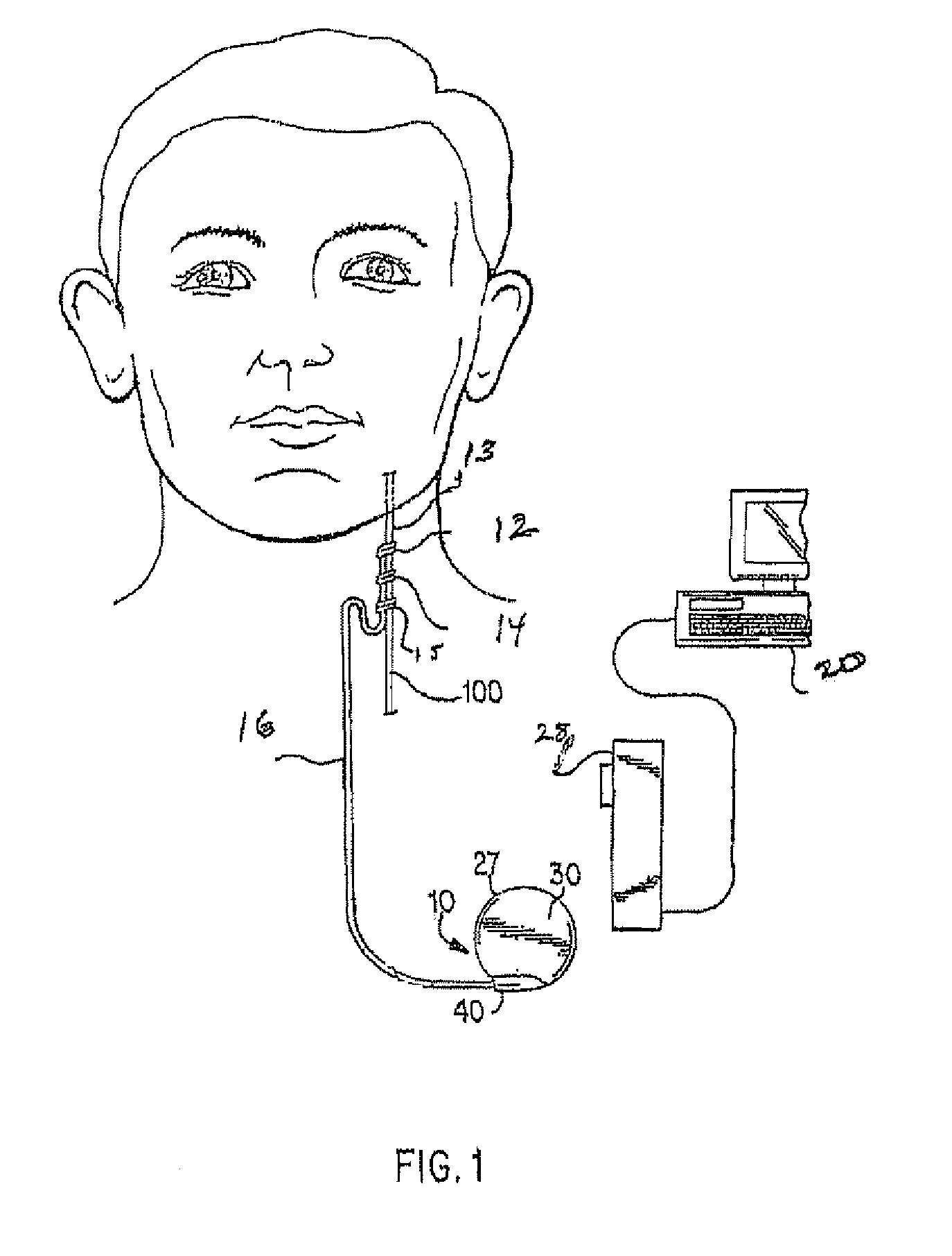 Trained and adaptive response in a neurostimulator