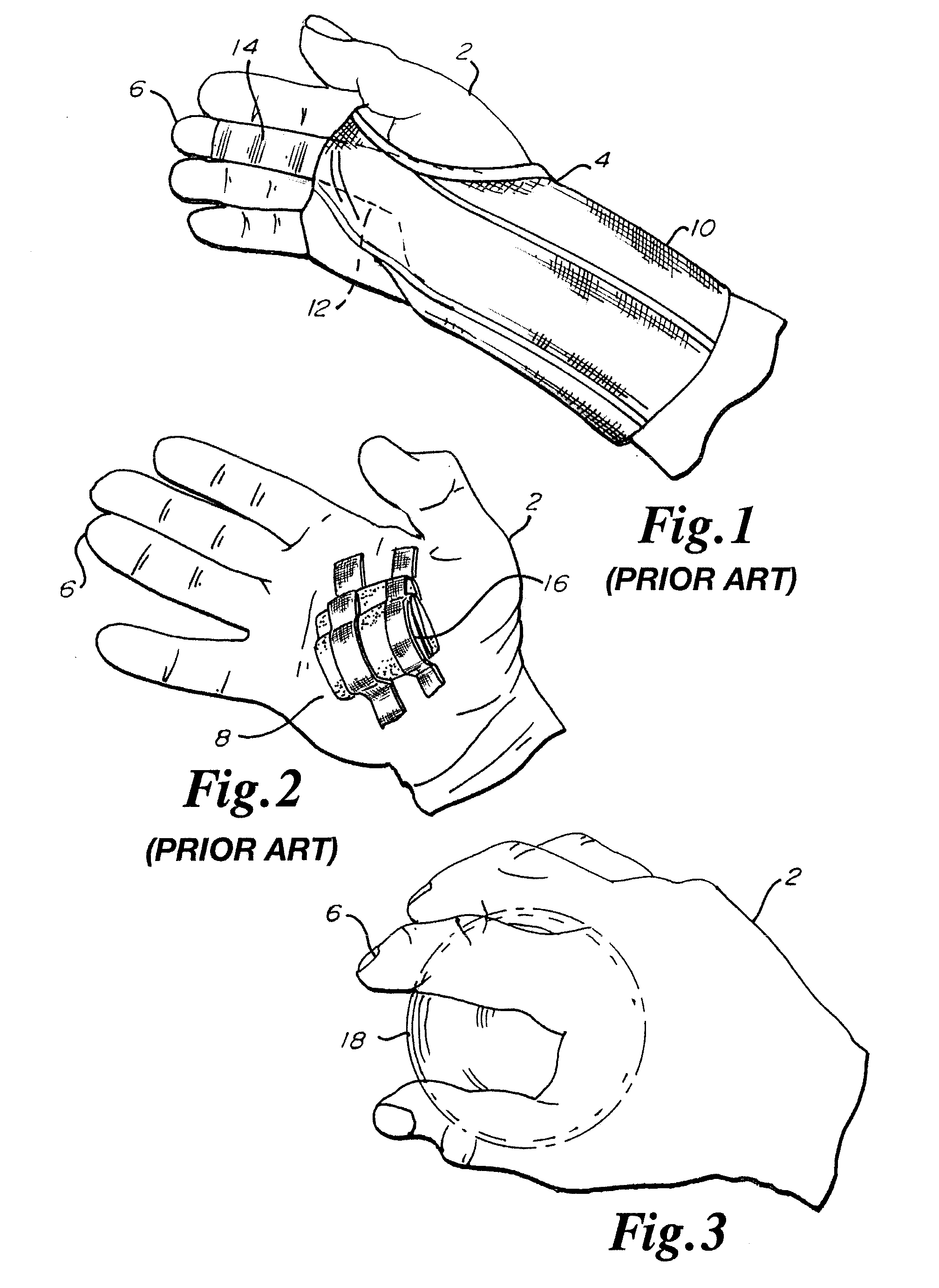 Spherical section hand splint