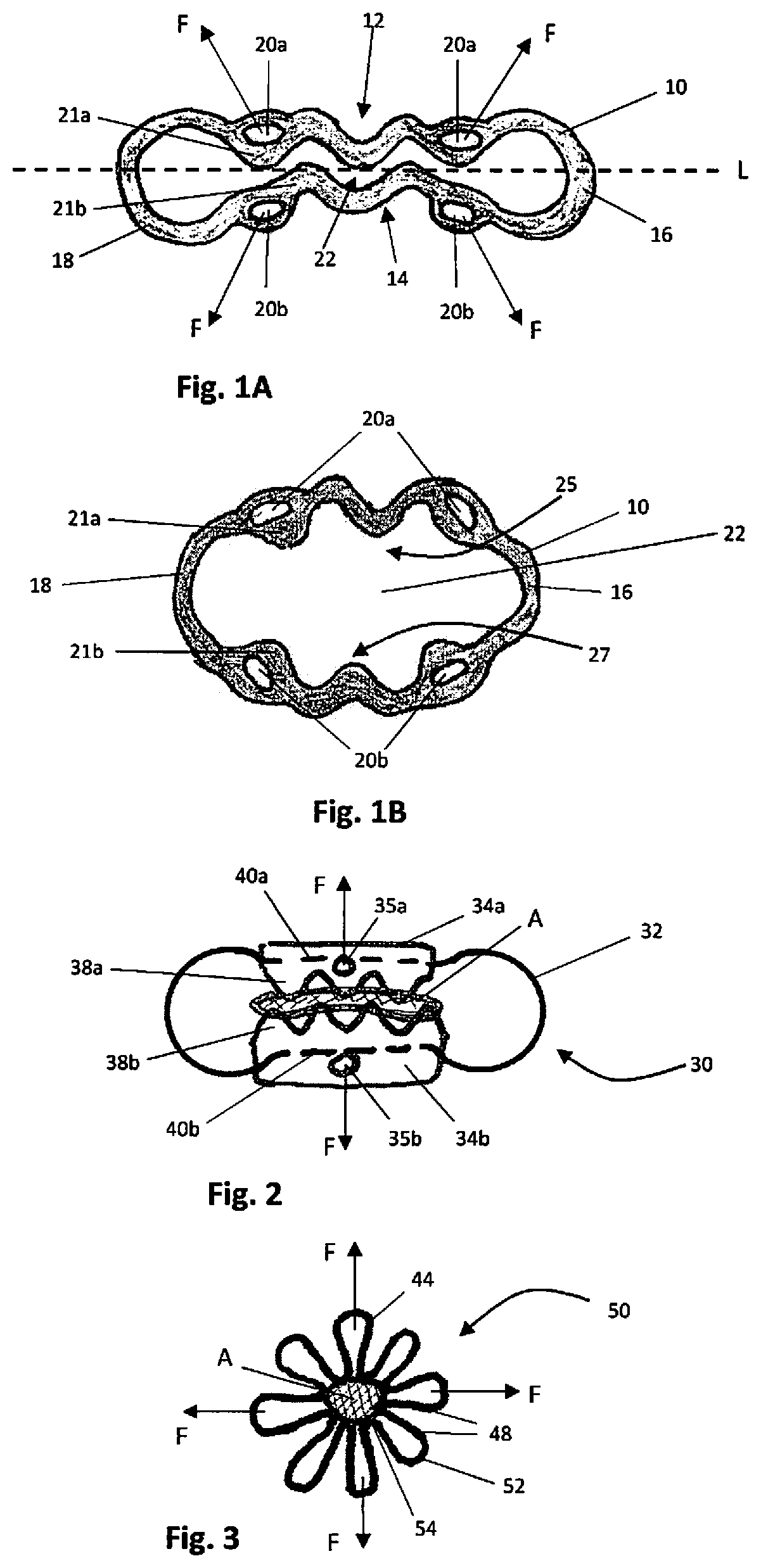 Surgical clip and deployment system