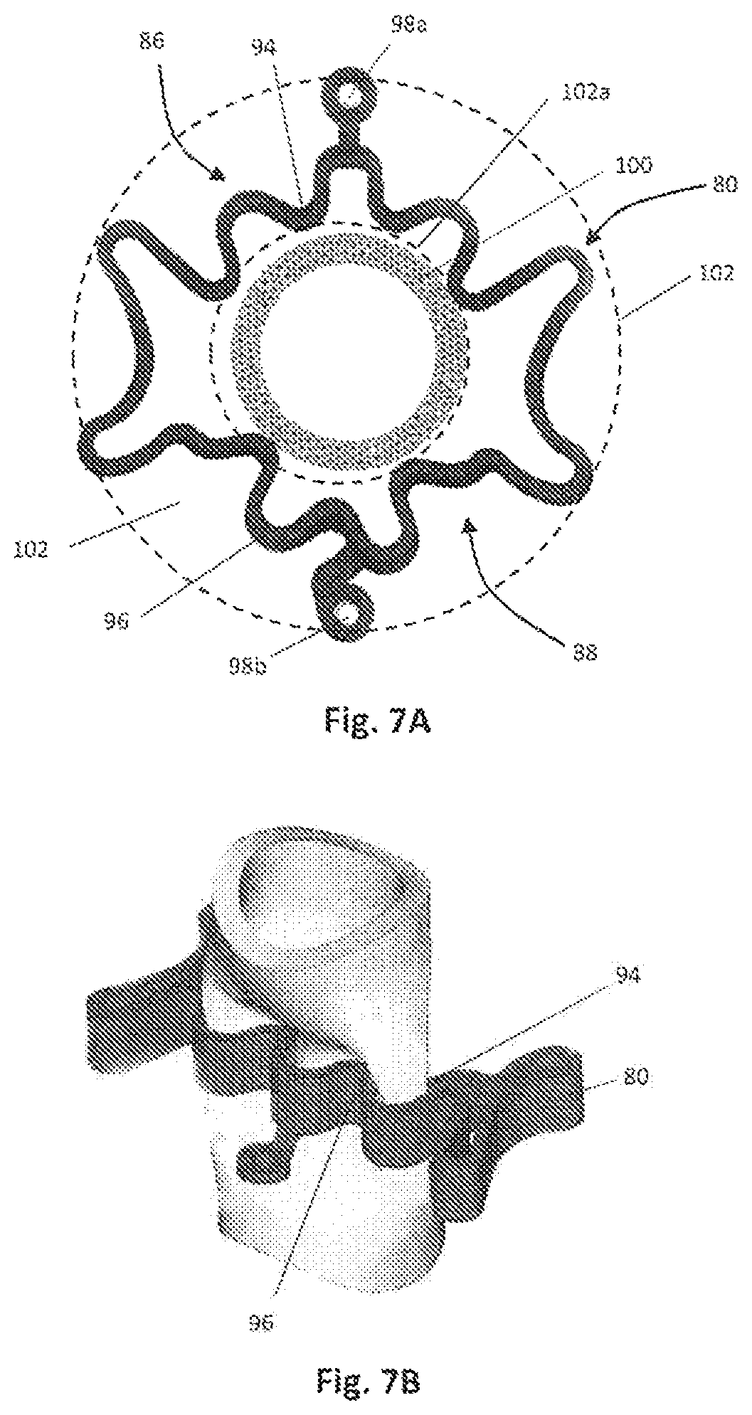 Surgical clip and deployment system