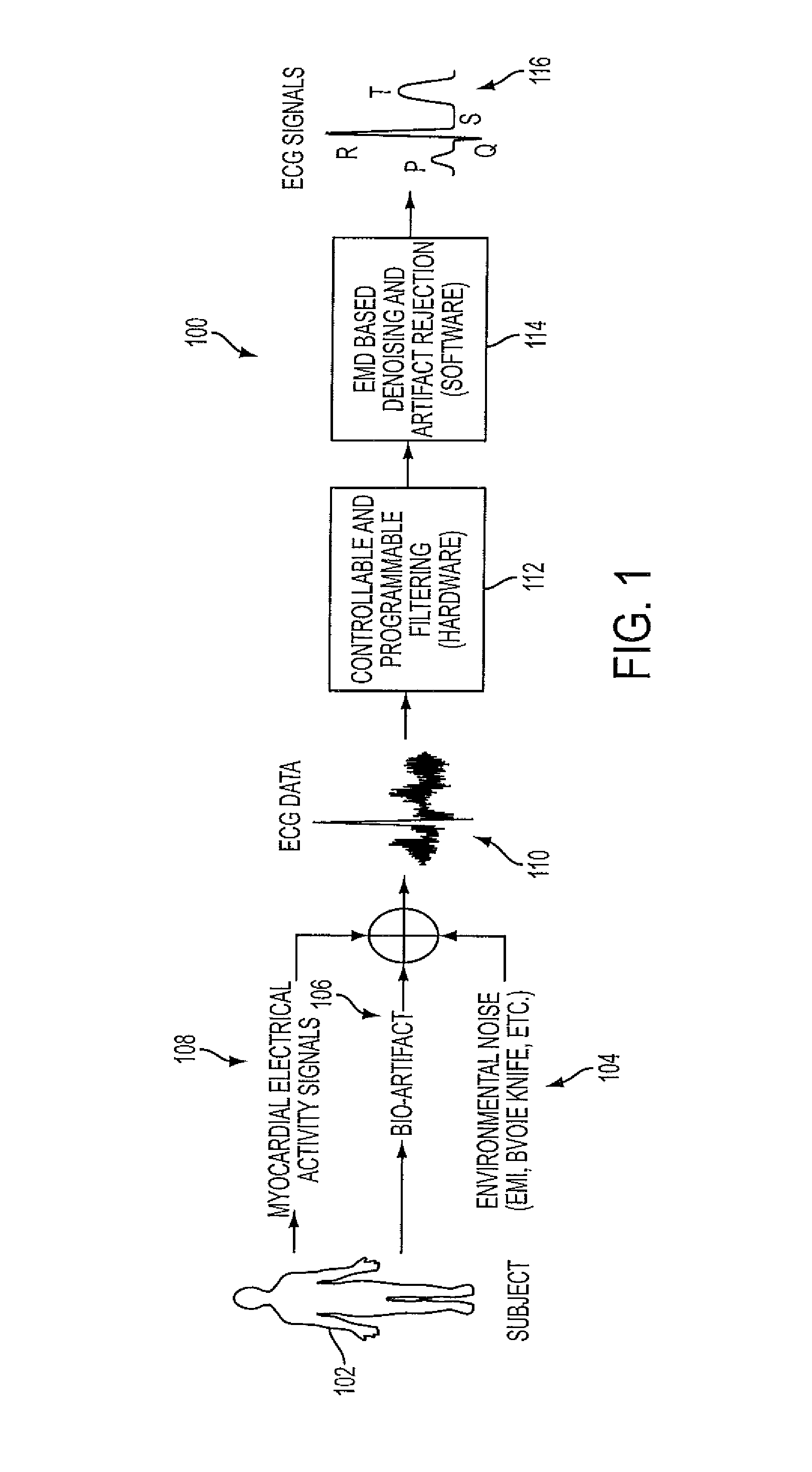 Denoising and artifact rejection for cardiac signal in a sensis system