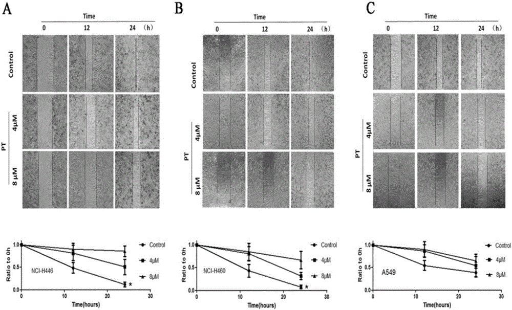 Application of parthenolide in preparation of lung cancer treating drug