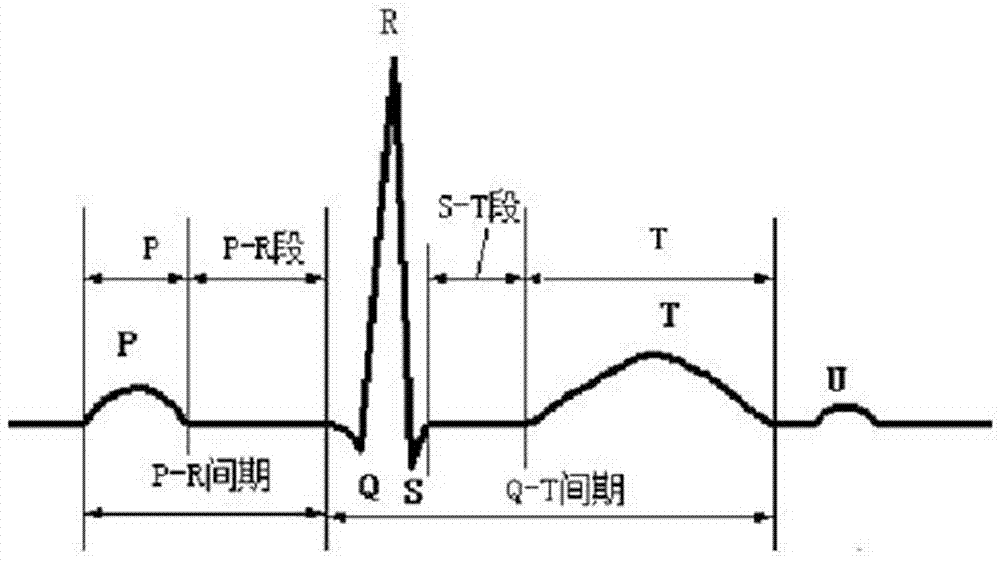 Real-time electrocardiosignal monitoring and processing method