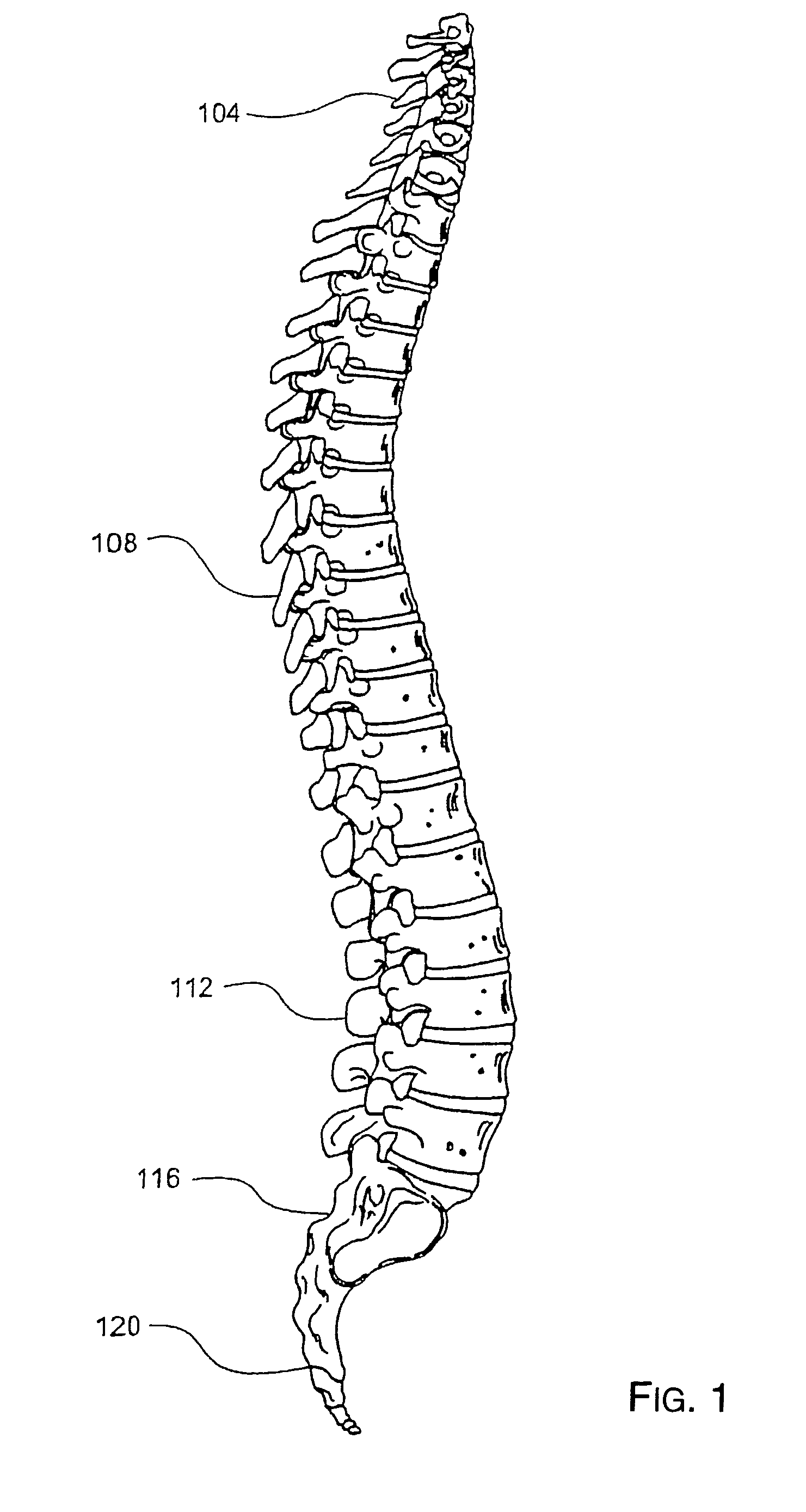 Spinal motion preservation assemblies