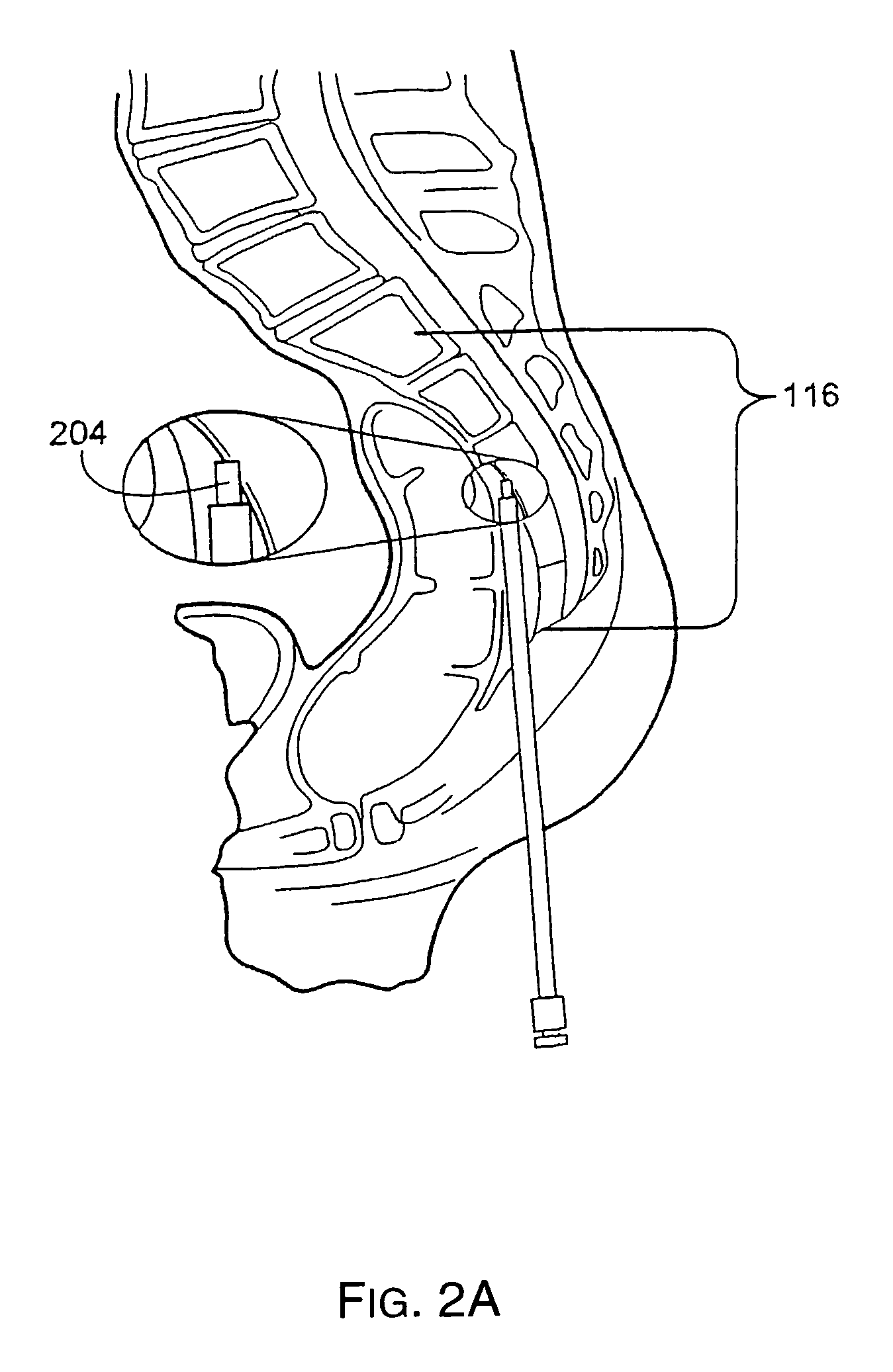 Spinal motion preservation assemblies