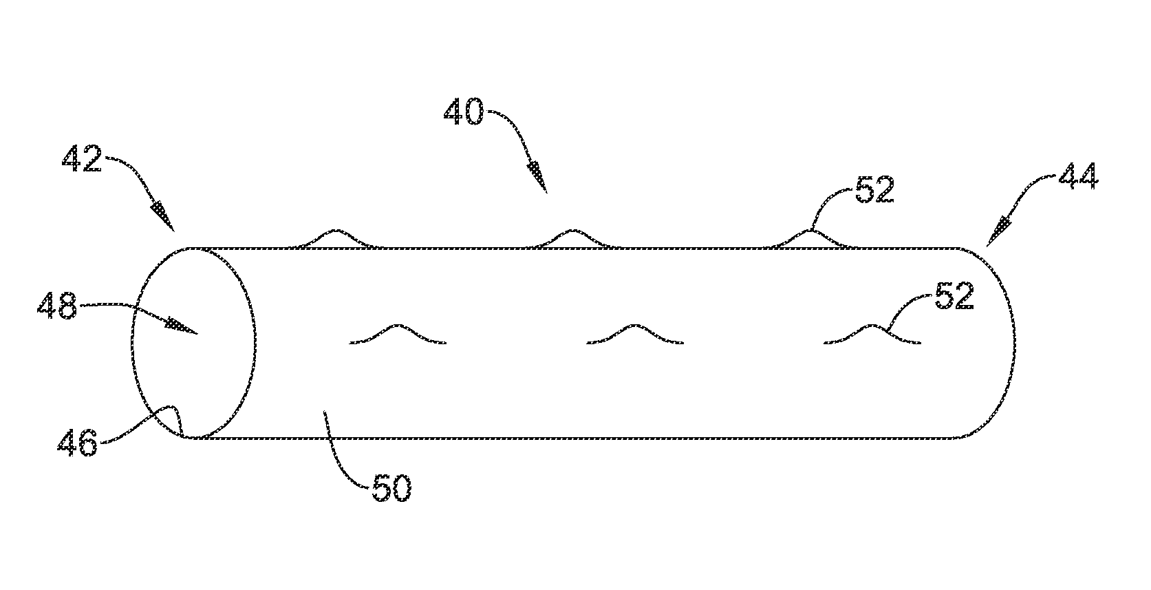 Tracheal stent