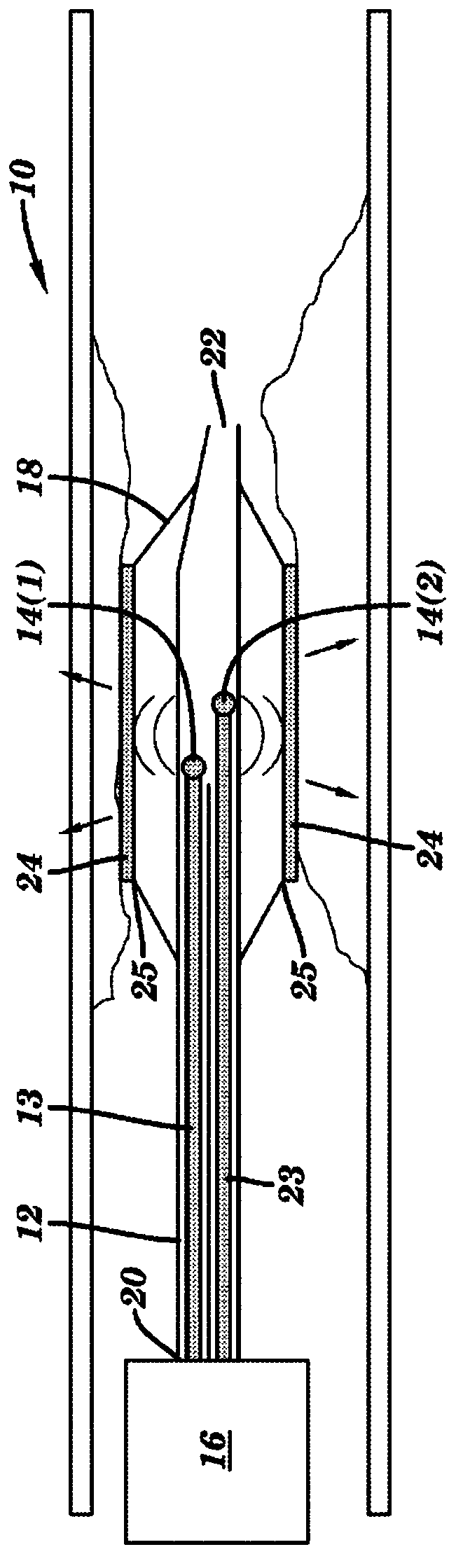 Method and device for enhanced composition delivery