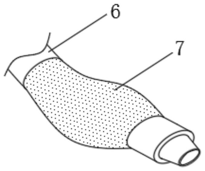 Gastrointestinal fluid decompression device for gastrointestinal surgery