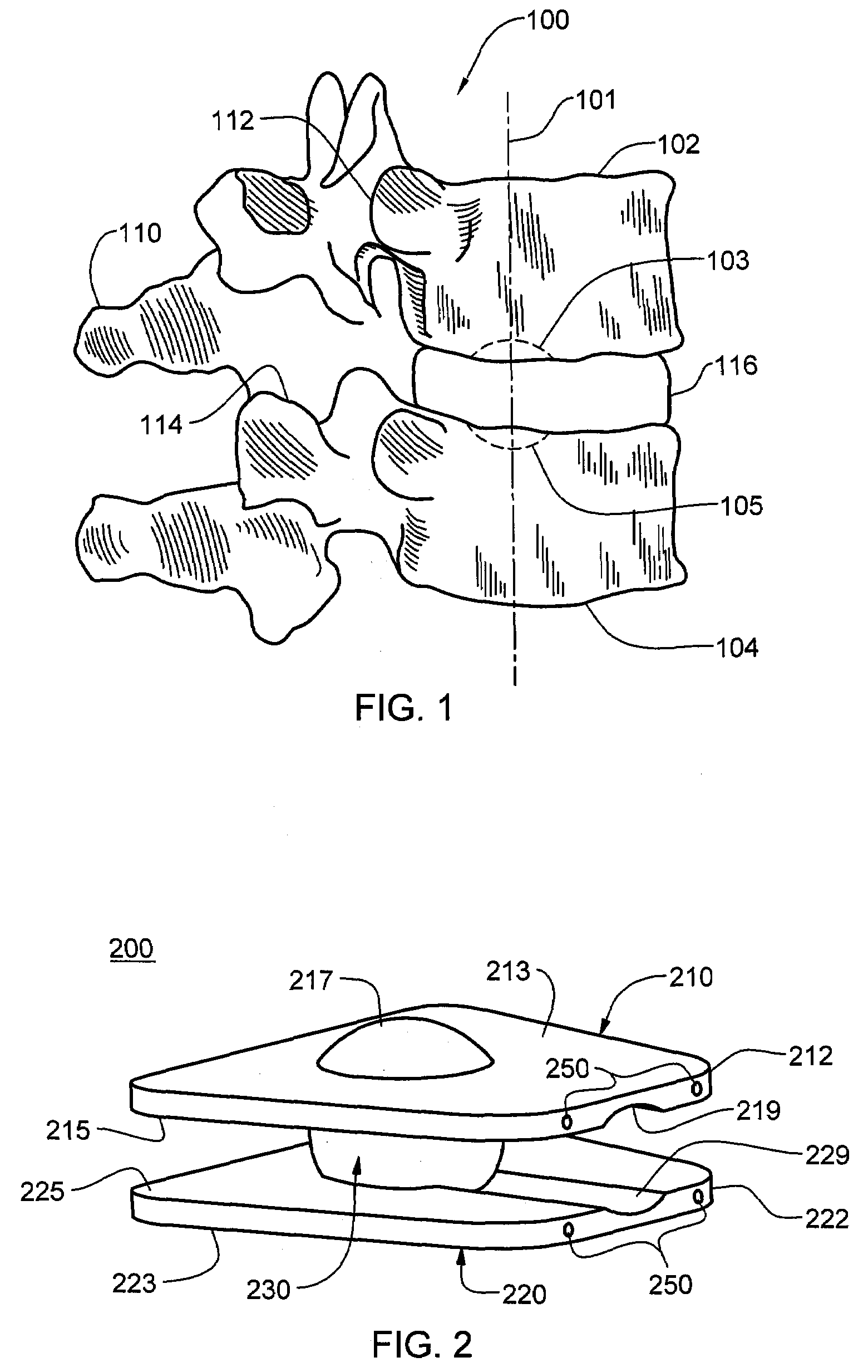 Intervertebral prosthetic devices and surgical methods