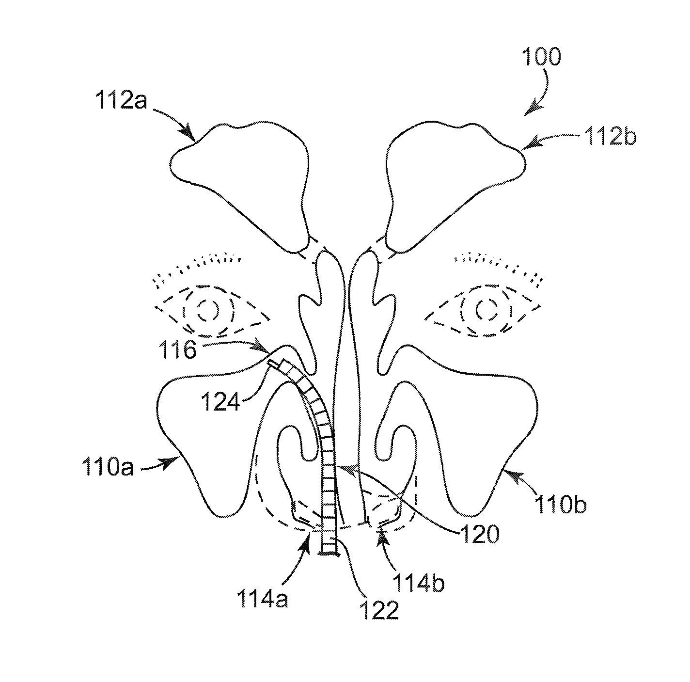 Rehydratable thiolated polysaccharide particles and sponge