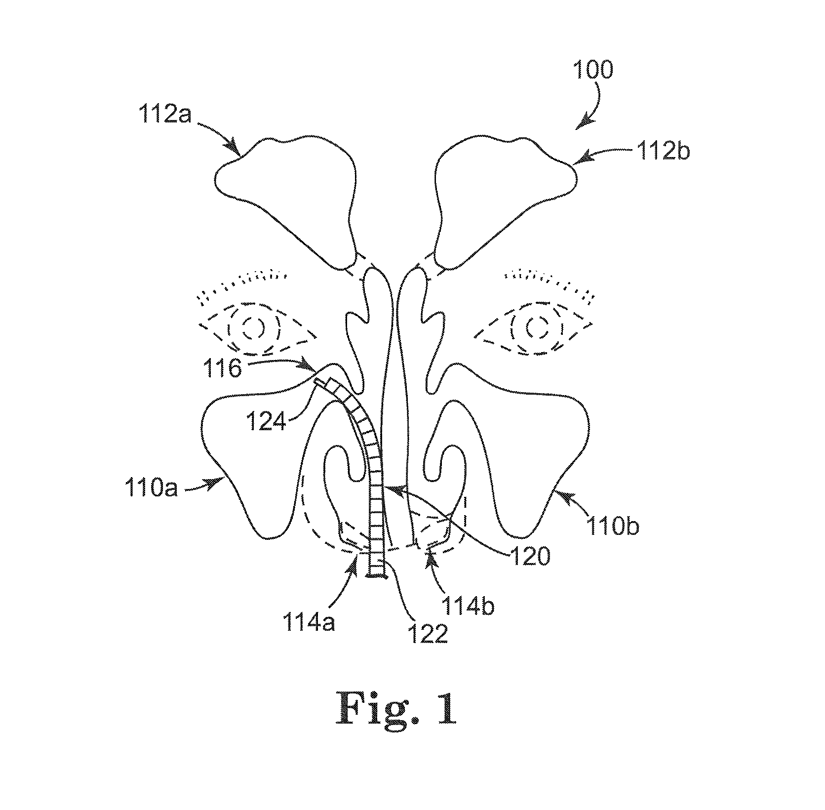 Rehydratable thiolated polysaccharide particles and sponge