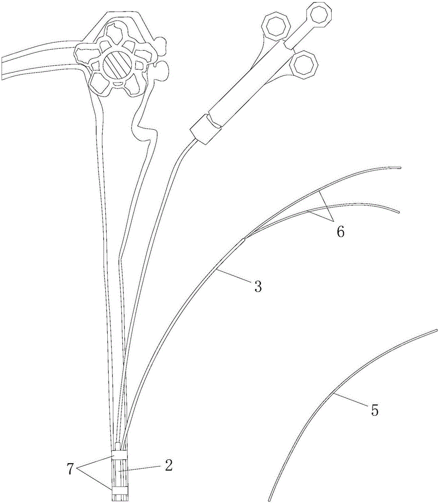 Simple auxiliary tube device for endoscopic treatment