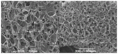 Controllable-degradation lacrimal passage suppository and preparation method thereof