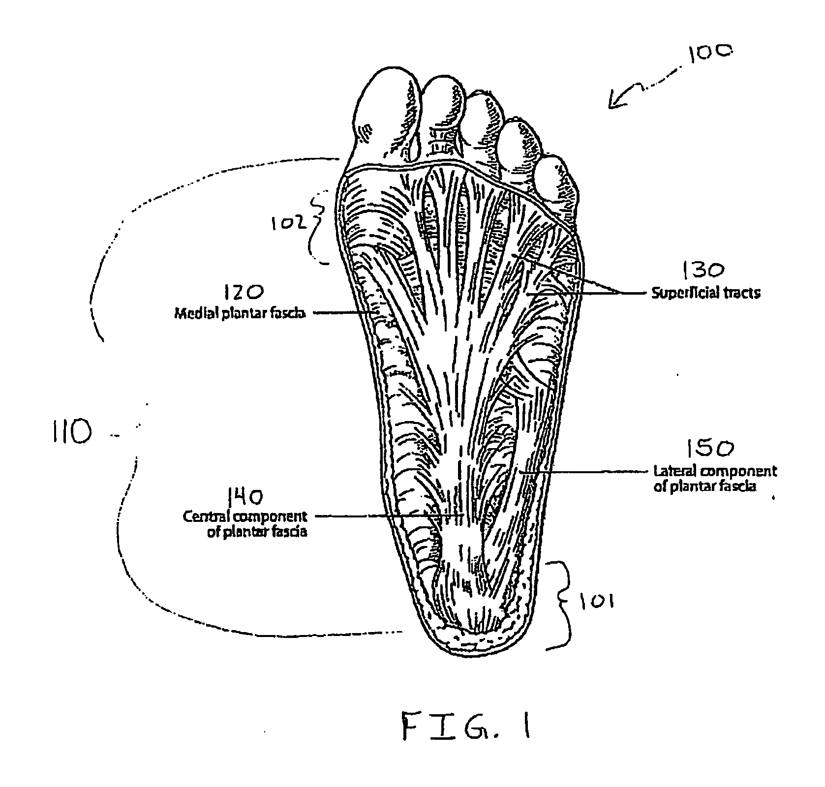 System for treatment of plantar fasciitis